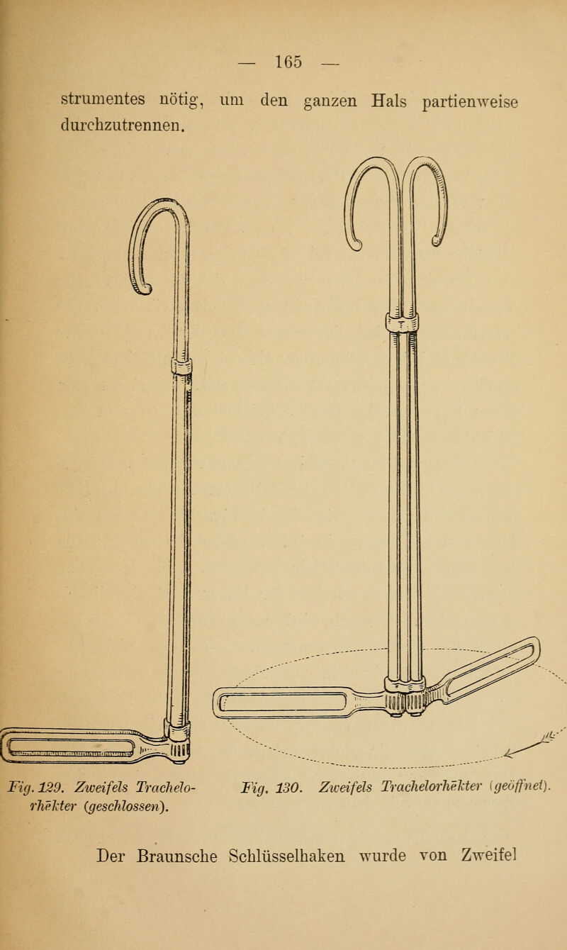 strumentes nötig, um den ganzen Hals partienweise durchzutrennen. 1 j'L- Fig. 129. Ziveifels TracJielo- rheJiter (geschlossen). Fig. 130. Ziveifels TrachelorheJcter {geöffnet). Der Braunsche Scblüsselhaken wurde von Zweifel