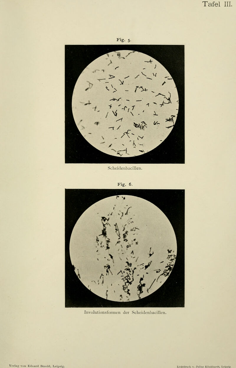 Fig. 5- Scheidenbacillen. Fig. 6. Involutionsformen der Scheidenbacillen.