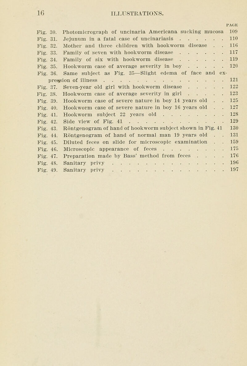 PAGE Fig. 30. Photomicrograpli of uncinaria Americana sucking mucosa 109 Fig. 31. Jejunum in a fatal case of uncinariasis 110 Fig. 32. Mother and three children with hookworm disease . . 116 Fig. 33. Family of seven with hookworm disease 117 Fig. 34. Family of six with hookworm disease 119 Fig. 35. Hookworm case of average severity in boy 120 Fig. 36. Same subject as Fig. 35—Slight edema of face and ex- pre^ion of illness 121 Fig. 37. Seven-year old girl with hookworm disease 122 Fig. 38. Hookworm case of average severity in girl 123 Fig. 39. Hookworm case of severe nature in boy 14 years old . . 125 Fig. 40. Hookworm case of severe nature in boy 16 years old . . 127 Fig. 41. Hookworm subject 22 years old 128 Fig. 42. Side view of Fig. 41 129 Fig. 43. Rontgenogram of hand of hookworm subject shown in Fig. 41 130 Fig. 44. Rontgenogram of hand of normal man 19 years old . . 131 Fig. 45. Diluted feces on slide for microscopic examination . . 159 Fig. 46. Microscopic appearance of feces 175 Fig. 47. Preparation made by Bass' method from feces .... 176 Fig. 48. Sanitary privy 196 Fig. 49. Sanitary privy 197