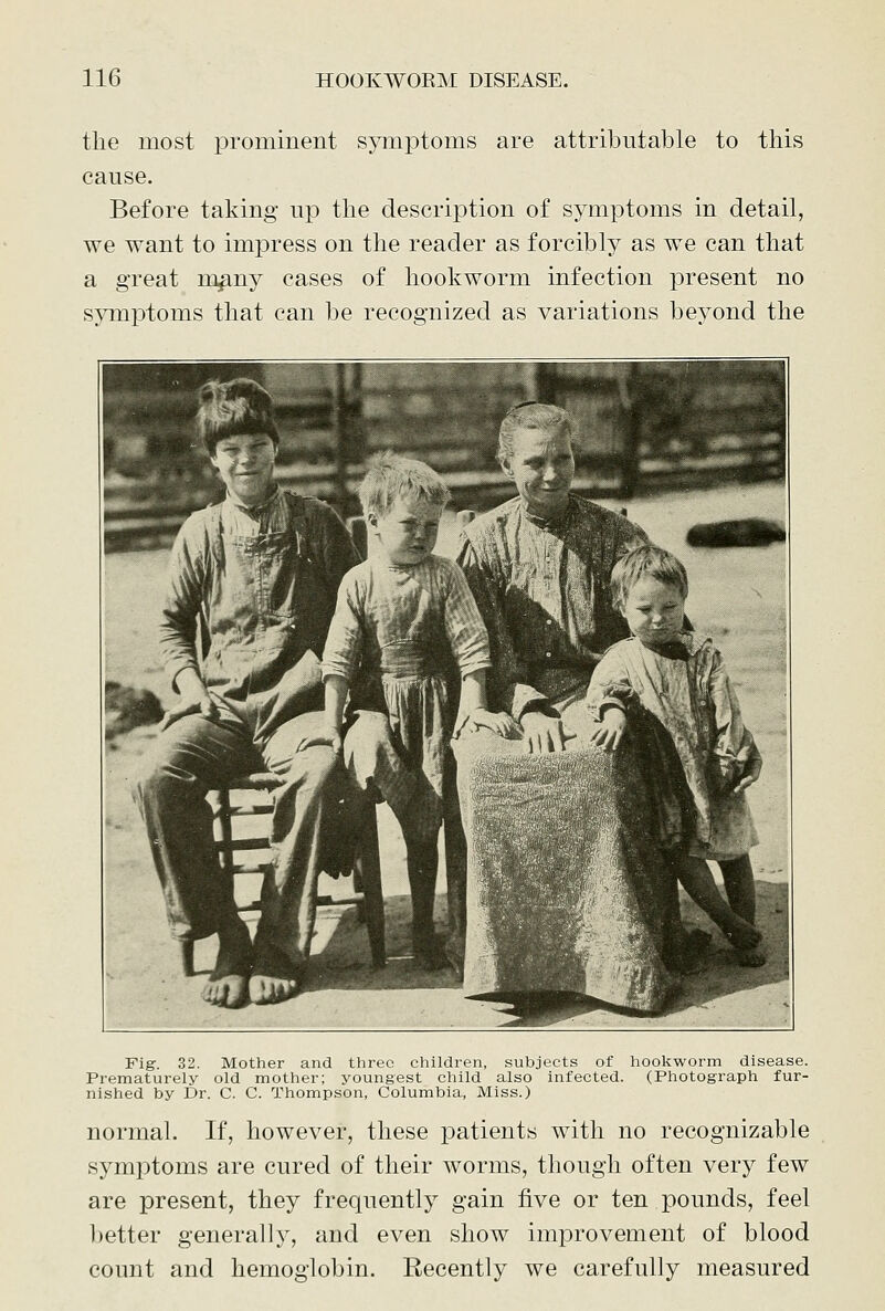 the most prominent symptoms are attributable to this cause. Before taking up the description of symptoms in detail, we want to impress on the reader as forcibly as we can that a great mpny cases of hookworm infection present no symptoms that can be recognized as variations beyond the Fig. 32. Mother and three children, subjects of hookworm disease. Prematurely old mother; youngest child also infected. (Photograph fur- nished by Dr. C. C. Thompson, Columbia, Miss.) normal. If, however, these patients with no recognizable symj)toms are cured of their worms, though often very few are present, they frequently gain five or ten pounds, feel better generally, and even show improvement of blood count and hemoglobin. Eecently we carefully measured