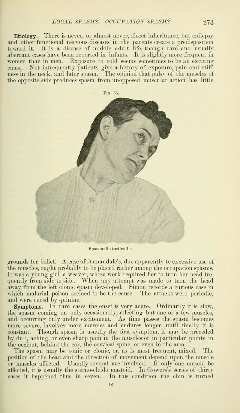 Etiology. There is never, or almost never, direct inheritance, but epilepsy and other functional nervous diseases in the parents create a predisposition toward it. It is a disease of middle adult life, though rare and usually aberrant cases have been reported in infants. It is slightly more frequent in women than in men. Exposure to cold seems sometimes to be an exciting cause. Not infrequently patients give a history of exposure, pain and stiff- ness in the neck, and later spasm. The opinion that palsy of the muscles of the opposite side produces spasm from unopposed muscular action has little Spasmodic torticollis. grounds for belief. A case of Annandale's, due apparently to excessive use of the muscles, ought probably to be placed rather among the occupation spasms. It was a young girl, a weaver, whose work required her to turn her head fre- quently from side to side. When any attempt was made to turn the head away from the left clonic spasm developed. Simon records a curious case in which malarial poison seemed to be the cause. The attacks were periodic, and were cured by quinine. Symptoms. In rare cases the onset is very acute. Ordinarily it is slow, the spasm coming on only occasionally, affecting but one or a few muscles, and occurring only under excitement. As time passes the spasm becomes more sevei'e, involves more muscles and endures longer, until finally it is constant. Though spasm is usually the first symptom, it may be preceded by dull, aching, or even sharp pain in the muscles or in particular points in the occiput, behind the ear, the cervical spine, or even in the arm. The spasm may be tonic or clonic, or, as is most frequent, mixed. The position of the head and the direction of movement depend upon the muscle or muscles affected. Usually several are involved. If only one muscle be affected, it is usually the sterno-cleido mastoid. In Gowers's series of thirty cases it happened thus in seven. In this condition the chin is turned 18