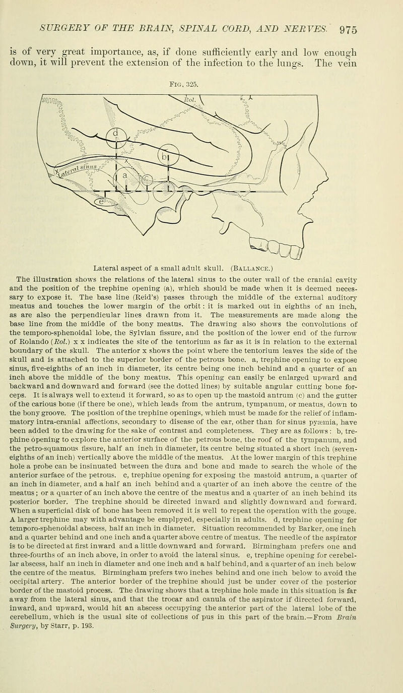 is of very great importauce, as, if done sufficiently early and low enough down, it will prevent the extension of the infection to the lungs. The vein Fig. 325. Lateral aspect of a small adult skull. (Ballance.) The illustration shows the relations of the lateral sinus to the outer wall of the cranial cavity and the position of the trephine opening (a), which should be made when it is deemed neces- sary to expose it. The base line (Reid's) passes through the middle of the external auditory meatus and touches the lower margin of the orbit: it is marked out in eighths of an inch, as are also the perpendicular lines drawn from it. The measurements are made along the base line from the middle of the bony meatus. The drawing also shows the convolutions of the temporo-sphenoidal lobe, the Sylvian fissure, and the position of the lower end of the furrow of Rolando [Rol.) s x indicates the site of the tentorium as far as it is in relation to the external boundary of the skull. The anterior x shows the point where the tentorium leaves the side of the skull and is attached to the superior border of the petrous bone, a, trephine opening to expose sinus, five-eighths of an inch in diameter, its centre being one inch behind and a quarter of an Inch above the middle of the bony meatus. This opening can easily be enlarged upward and backward and downward and forward (see the dotted lines) by suitable angular cutting bone for- ceps. It is always well to extend it forward, so as to open up the mastoid antrum (c) and the gutter of the carious bone (if there be one), which leads from the antrum, tympanum, or meatus, down to the bony groove. The position of the trephine openings, which must be made for the relief of inflam- matory intra-cranial affections, secondary to disease of the ear, other than for sinus pyaemia, have been added to the drawing for the sake of contrast and completeness. They are as follows : b, tre- phine opening to explore the anterior surface of the petrous bone, the roof of the tympanum, and the petro-squamous fissure, half an inch in diameter, its centre being situated a short inch (seven- eighths of an inch) vertically above the middle of the meatus. At the lower margin of this trephine hole a probe can be insinuated between the dura and bone and made to search the whole of the anterior surface of the petrous, c, trephine opening for exposing the mastoid antrum, a quarter of an inch in diameter, and a half an inch behind and a quarter of an inch above the centre of the meatus; or a quarter of an inch above the centre of the meatus and a quarter of an inch behind its posterior border. The trephine should be directed inward and slightly downward and forward. When a superficial disk of bone has been removed it is well to repeat the operation with the gouge. A larger trephine may with advantage be emplpyed, especially in adults, d, trephine opening for temporo-sphenoidal abscess, half an inch in diameter. Situation recommended by Barker, one inch and a quarter behind and one inch and a quarter above centre of meatus. The needle of the aspirator is to be directed at first inward and a little downward and forward. Birmingham prefers one and three-fourths of an inch above, in order to avoid the lateral sinus, e, trephine opening for cerebel- lar abscess, half an inch in diameter and one inch and a half behind, and a quarter of an inch below the centre of the meatus. Birmingham prefers two inches behind and one inch below to avoid the occipital artery. The anterior border of the trephine should just be under cover of the posterior border of the mastoid process. The drawing shows that a trephine hole made in this situation is far away from the lateral sinus, and that the trocar and canula of the aspirator if directed forward, inward, and upward, would hit an abscess occupj'ing the anterior part of the lateral lobe of the cerebellum, which is the usual site of collections of pus in this part of the brain.—From Brain Surgery, by Starr, p. 193.