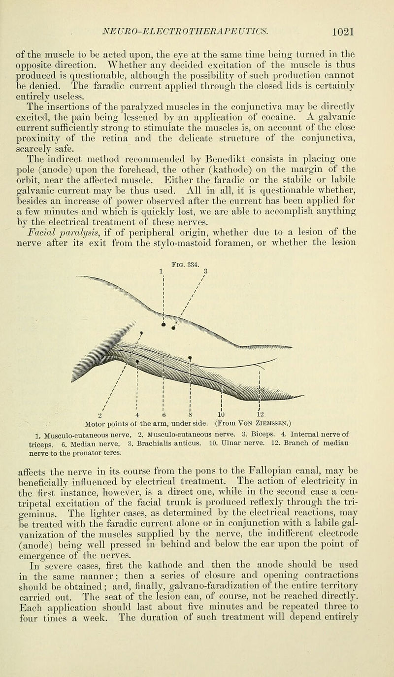 of the muscle to be acted upon, the eye at the same time being turned in the opposite direction. Whether any decided excitation of the muscle is thus produced is questionable, although the possibility of such production cannot be denied. The faradic current applied through the closed lids is certainly entirely useless. The insertions of the paralyzed muscles in the conjunctiva may be directly excited, the pain being lessened by an application of cocaine. A galvanic current sufficiently strong to stimulate the muscles is, on account of the close proximity of the retina and the delicate structure of the conjunctiva, scarcely safe. The indirect method recommended by Benedikt consists in placing one pole (anode) upon the forehead, the other (kathode) on the margin of the orbit, near the affected muscle. Either the faradic or the stabile or labile galvanic current may be thus used. All in all, it is questionable whether, besides an increase of power observed after the current has been applied for a few minutes and which is quickly lost, we are able to accomplish anything by the electrical treatment of these nerves. Facial paralysis, if of peripheral origin, whether due to a lesion of the nerve after its exit from the stylo-mastoid foramen, or whether the lesion Fig. 334. 1 3 Motor points of the arm, under side. (From Von Ziemssen.) 1. Musculo-cutaneous nerve. 2. JMusculo-cutaneous nerve. 3. Biceps. 4. Internal nerve of triceps. 6. Median nerve, 8. Brachialis anticus. 10. Ulnar nerve. 12. Branch of median nerve to the pronator teres. affects the nerve in its course from the pons to the Fallopian canal, may be beneficially influenced by electrical treatment. The action of electricity in the first instance, however, is a direct one, while in the second case a cen- tripetal excitation of the facial trunk is produced reflexly through the tri- geminus. The lighter cases, as determined by the electrical reactions, may be treated with the faradic current alone or in conjunction with a labile gal- vanization of the muscles supplied by the nerve, the indifferent electrode (anode) being well pressed in behind and below the ear upon the point of emergence of the nerves. In severe cases, first the kathode and then the anode should be used in the same manner; then a series of closure and opening contractions should be obtained; and, finally, galvano-faradization of the entire territory carried out. The seat of the lesion can, of course, not be reached directly. Each application should last about five minutes and be repeated three to four times a week. The duration of such treatment will depend entirely