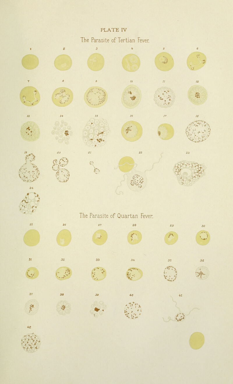 The Parasite of Tertian Fever. ■ «ij « 4^f ■■/■^ *$$& <**$ 'X The Parasite of Quartan Fever. V/ ft # +2 si > Ji *■. L'.»