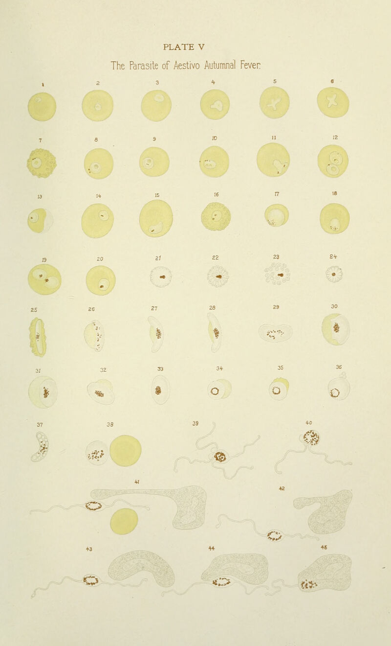 PLATE V The Parasite of Aestivo Autumnal Fever *& * S2 2<f- o O u 37 :-a ^ ^ *3 ♦4 i^> <*,,/ o •c* *i*