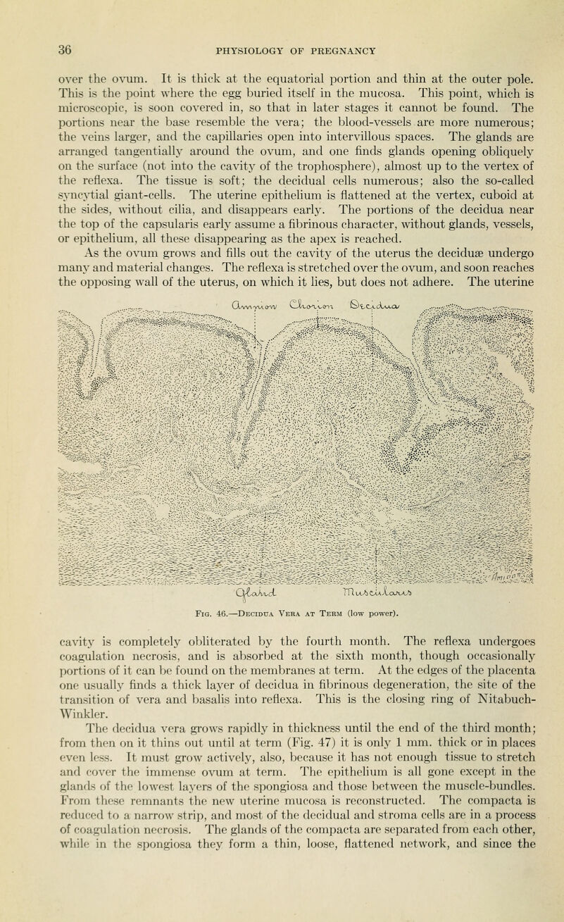 over the ovuni. It is thick at the equatorial portion and thin at the outer pole. This is the point where the egg buried itself in the mucosa. This point, which is microscopic, is soon covered in, so that in later stages it cannot be found. The portions near the base resemble the vera; the blood-vessels are more numerous; the veins larger, and the capillaries open into intervillous spaces. The glands are arranged tangentially around the ovum, and one finds glands opening obliquely on the surface (not into the cavity of the trophosphere), almost up to the vertex of the reflexa. The tissue is soft; the decidual cells numerous; also the so-called S3'nc^'tial giant-cells. The uterine epithelium is flattened at the vertex, cuboid at the sides, without cilia, and disappears early. The portions of the decidua near the top of the capsularis early assume a fibrinous character, without glands, vessels, or epithelium, all these disappearing as the apex is reached. As the ovum grows and fills out the cavity of the uterus the deciduse undergo many and material changes. The reflexa is stretched over the ovum, and soon reaches the opposing wall of the uterus, on which it lies, but does not adhere. The uterine CAaaaaoao-vv LIXloa-voti !cytOLCX/>-*-ai/ ..■■.•:■.■■;--•':'.• •.••;■•. •,•■:•.■-'.-.•• Fig. 46.—Decidua Veka at Term (low power). cavity is completely obliterated by the fourth month. The reflexa undergoes coagulation necrosis, and is absorbed at the sixth month, though occasionally portions of it can be found on the membranes at term. At the edges of the placenta one usually finds a thick layer of decidua in fibrinous degeneration, the site of the transition of vera and basalis into reflexa. This is the closing ring of Nitabuch- Winkler. The decidua vera grows rapidly in thickness until the end of the third month; from then on it thins out until at term (Fig. 47) it is only 1 mm. thick or in places even less. It must grow actively, also, because it has not enough tissue to stretch and cover the immense ovum at term. The epithelium is all gone except in the glands of the lowest layers of the spongiosa and those between the muscle-bundles. From these remnants the new uterine mucosa is reconstructed. The compacta is reduced to a narrow strip, and most of the decidual and stroma cells are in a process of coagulation necrosis. The glands of the compacta are separated from each other, while in the spongiosa they form a thin, loose, flattened network, and since the