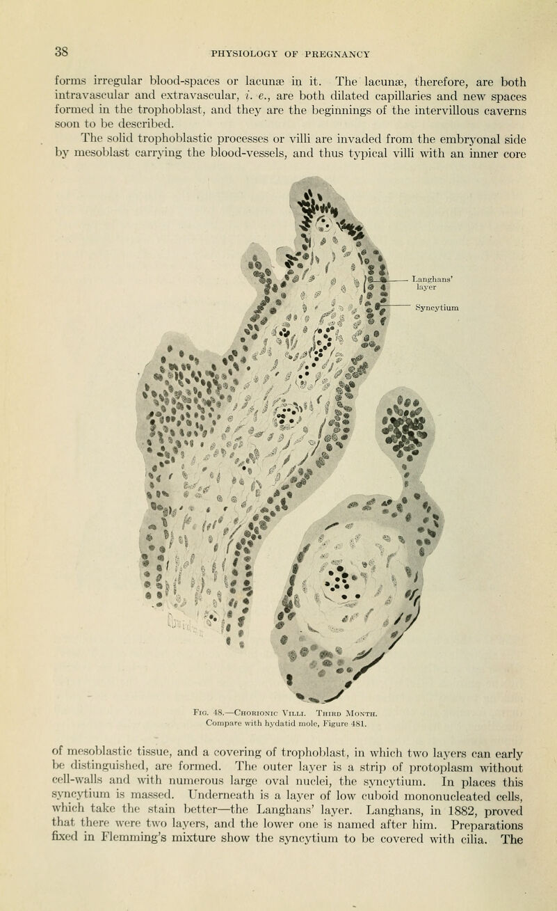 forms irregular blood-spaces or lacunae in it. The lacunae, tiherefore, are both intravascular and extravascular, i. e., are both dilated capillaries and new spaces formed in the trophoblast, and they are the beginnings of the intervillous caverns soon to be described. The solid trophoblastic processes or villi are invaded from the embryonal side by mesoblast carrying the blood-vessels, and thus typical villi with an inner core A». *r% ^1 s % ^ 9 % Langhana' layer Syncytium Fig. 48.—Chorionic Villi. Third Month. Compare with hydatid mole, Figure 481. of mosoblastic tissue, and a covering of trophoblast, in which two layers can early be distinguished, are formed. The outer layer is a strip of protoplasm without cell-walls and with numerous large oval nuclei, the syncytium. In places this syncytium is massed. Underneath is a layer of low cuboid mononucleated cells, which take the stain better—the Langhans' layer. Langhans, in 1882, proved that there were two layers, and the lower one is named after him. Preparations fixed in Flemming's mixture show the syncytium to be covered with cilia. The