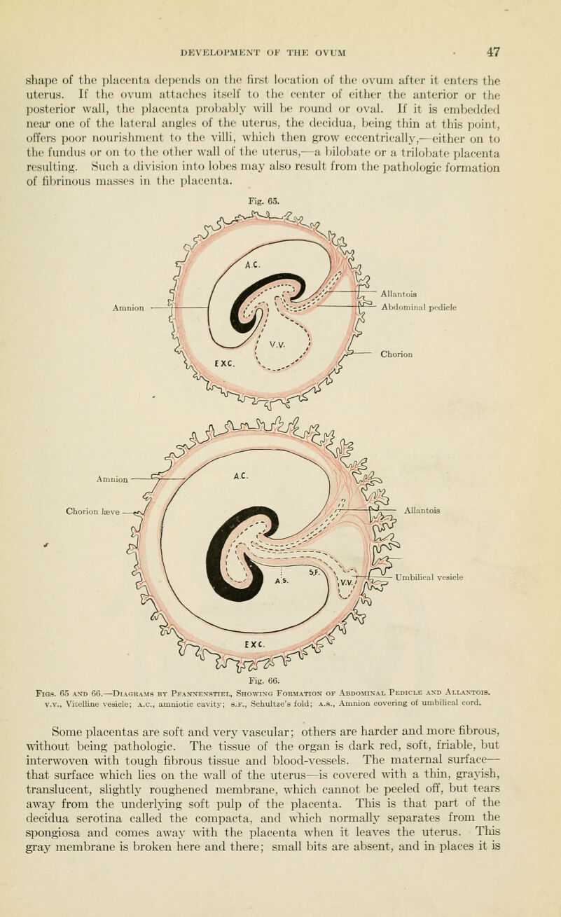 shape of the placenta depends on the first location of the ovum after it enters the uterus. If the ovum attaches itself to the center of either the anterior or the posterior wall, the placenta prol)ably will be round or oval. If it is embedded near one of the lateral anfi;l(>s of the uterus, the decidua, beiiifi; thin at this point, offers poor uourisiinieut to the villi, which then grow eccentrically,—either on to the fundus or on to the other wall of the uterus,—a liilobate or a trilobate placenta resulting. Such a division into lobes may also result from tlic jjuthoiogic formation of fibrinous masses in the placenta. Fig. 65. Amnion Amnion Chorion laeve Allantois Alxloniinal pfdicle Chorion Allantois Umbilical vesicle Fig. 66. Figs. 65 and 66.—Diagrams by Pfannenstiel, Showing Form.\.tion of Abdominal Pedicle and All.\xtoi8. V.V., Vitelline vesicle; a.c, amniotic cavity; s.f., Schultze's fold; a.s., Amnion covering of umbilical cord. Some placentas are soft and very vascular; others are harder and more fibrous, without being pathologic. The tissue of the organ is dark red, soft, friable, but interwoven with tough fibrous tissue and blood-vessels. The maternal surface— that surface which lies on the wall of the uterus—is covered with a thin, grayish, translucent, slightly roughened membrane, which cannot be peeled off, but tears away from the underlying soft pulp of the placenta. This is that part of the decidua serotina called the compacta, and which normally separates from the spongiosa and comes away wdth the placenta when it leaves the uterus. This gray membrane is broken here and there; small bits are absent, and in places it is