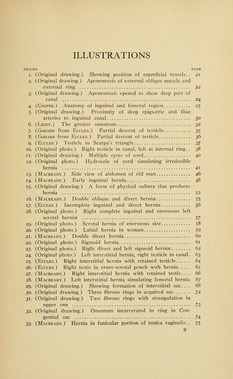 ILLUSTRATIONS FIGURR PAGE 4- 5- 6. 7- 8. 9- 10. II. 12. 13- 14. IS- 16. 17- 18. 19. 20. 21. 22. 22- 24. 25- 26. 27. 28. 29. 30. 31- 32. 33- Original drawing.) Showing position of superficial vessels.. 21 Original drawing.) Aponeurosis of external oblique muscle and external ring 22 Original drawing.) Aponeurosis opened to show deep part of canal 24 Cooper.) Anatomy of inguinal and femoral region 25 Original drawing.) Proximity of deep epigastric and iliac arteries to inguinal canal 30 Leidy.) The greater omentum 32 GoDARD from Eccles.) Partial descent of testicle 35 GoDARD from Eccles.) Partial descent of testicle 2>^ Eccles.) Testicle in Scarpa's triangle 27 Original photo.) Right testicle in canal, left at internal ring. . 38 Original drawing.) Multiple cysts of cord 40 Original photo.) Hydrocele of cord simulating irreducible hernia 41 Macready.) Side view of abdomen of old man 46 Macready.) Early inguinal hernia 48 Original drawing.) A form of physical culture that produces hernia 52 Macready.) Double oblique and direct hernise 55 Eccles.) Incomplete inguinal and direct hernise 56 Original photo.) Right complete inguinal and enormous left scrotal hernias 57 Original photo.) Scrotal hernia of enormous size 58 Original photo.) Labial hernia in woman 59 Macready.) Double direct hernia 60 Original photo.) Sigmoid hernia 61 Original photo.) Right direct and left sigmoid hernije 62 Original photo.) Left interstitial hernia, right testicle in canal. 63 Eccles.) Right interstitial hernia with retained testicle 64 Eccles.) Right testis in cruro-scrotal pouch with hernia 65 Macready.) Right interstitial hernia with retained testis.... 66 Macready.) Left interstitial hernia simulating femoral hernia. 67 Original drawing.) Showing formation of interstitial sac... 68 Original drawing.) Three fibrous rings in acquired sac 72 Original drawing.) Two fibrous rings with strangulation in upper one 72 Original drawing.) Omentum incarcerated in ring in Con- genital sac 74 Macready.) Hernia in funicular portion of tunica vaginalis.. 75