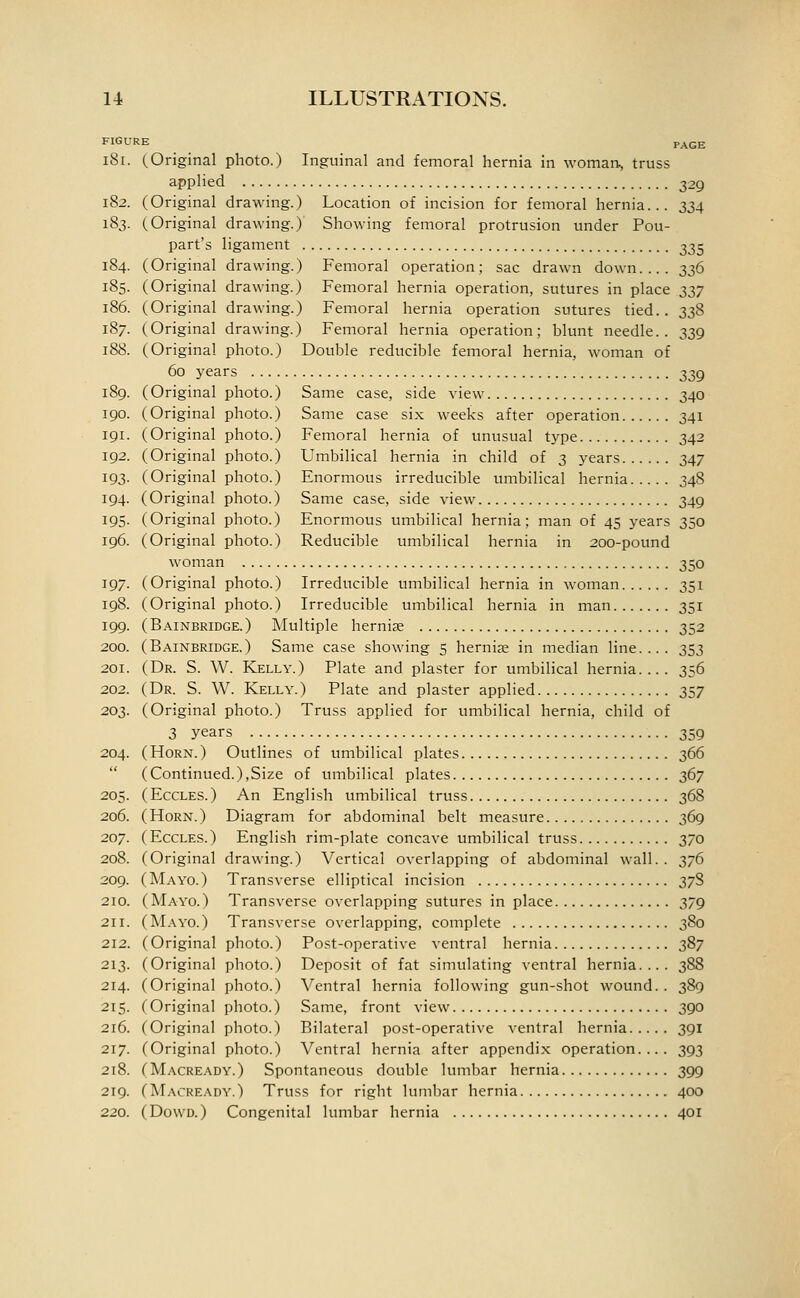 FIGURE PAGE i8i. (Original photo.) Inguinal and femoral hernia in woman., truss applied 329 182. 183. 184. 185. 186. 187. 188. 189. 190. 191. 192. 193- 194. 195- 196. 197. 198. 199. 200. 201. 202. 203. 204. 205. 206. 207. 208. 209. 210. 211. 212. 213. 214. 215- 216. 217. 218. 219. 220. Original drawing.) Location of incision for femoral hernia... 334 Original drawing.) Showing femoral protrusion under Pou- part's ligament 335 Original drawing.) Femoral operation; sac drawn down.... 336 Original drawing.) Femoral hernia operation, sutures in place 337 Original drawing.) Femoral hernia operation sutures tied.. 338 Original drawing.) Femoral hernia operation; blunt needle.. 339 Original photo.) Double reducible femoral hernia, woman of 60 j-ears 339 Original photo.) Same case, side view 340 Original photo.) Same case six weeks after operation 341 Original photo.) Femoral hernia of unusual type 342 Original photo.) Umbilical hernia in child of 3 years 347 Original photo.) Enormous irreducible umbilical hernia 348 Original photo.) Same case, side view 349 Original photo.) Enormous umbilical hernia; man of 45 years 350 Original photo.) Reducible umbilical hernia in 200-pound woman 350 Original photo.) Irreducible umbilical hernia in woman 351 Original photo.) Irreducible umbilical hernia in man 351 Bainbridge.) Multiple hernije 352 Bainbridge.) Same case showing 5 hernise in median line.... 353 Dr. S. W. Kelly.) Plate and plaster for umbilical hernia.... 356 Dr. S. W. Kelly.) Plate and plaster applied 357 Original photo.) Truss applied for umbilical hernia, child of 3 years 359 Horn.) Outlines of umbilical plates 366 Continued.),Size of umbilical plates 367 EccLES.) An English umbilical truss 368 Horn.) Diagram for abdominal belt measure 369 EccLES.) English rim-plate concave umbilical truss 370 Original drawing.) Vertical overlapping of abdominal wall. . 376 Mayo.) Transverse elliptical incision 37S Mayo.) Transverse overlapping sutures in place 379 M.\YO.) Transverse overlapping, complete 380 Original photo.) Post-operative ventral hernia 387 Original photo.) Deposit of fat simulating ventral hernia.... 388 Original photo.) Ventral hernia following gun-shot wound. . 389 Original photo.) Same, front view 390 Original photo.) Bilateral post-operative ventral hernia 391 Original photo.) Ventral hernia after appendix operation.... 393 Macready.) Spontaneous double lumbar hernia 399 Macready.) Truss for right lumbar hernia 400 DowD.) Congenital lumbar hernia 401