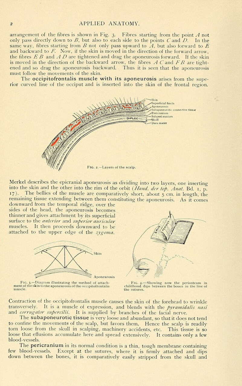 arrangement of the fibres is shown in Fig. 3. Fibres starting from the point A not only pass directly down to B, but also to each side to the points Cand /?. In the same way, fibres starting from B not only pass upward to .-J, but also forward to £ and backward to -F. Now, if the skin is moved in the direction of the forward arrow, the fibres £ B and A D are tightened and drag the aponeurosis forward. If the skin is moved in the direction of the backward arrow, the fibres A C and FB are tight- ened and so drag the aponeurosis backward. Thus it is seen that the aponeurosis must follow the movements of the skin. The occipitofrontalis muscle with its aponeurosis arises from the supe- rior curved line of the occiput and is inserted into the skin of the frontal region. Merkel describes the epicranial aponeurosis as dividing into two layers, one inserting into the skin and the other into the rim of the orbit {Hand, der top. Anat. Bd. i, p. 17). _ The bellies of the muscle are comparatively short, about 5 cm. in length, the remaining tissue extending between them constituting the aponeurosis. As it comes downward from the temporal ridge, over the sides of the head, the aponeurosis becomes thinner and gives attachment by its superficial surface to the anterior and superior ajiriadar muscles. It then proceeds downward to be attached to the upper edge of the zygoma. Fig. 3.—Diagram illustrating the method of attach- ment of theskin to the aponeurosis of the occipitofrontalis muscle. Fig. 4.—Showing now the periosteun childhood dips between the bones in tlie lii the sutures. Contraction of the occipitofrontalis muscle causes the skin of the forehead to wrinkle transversely. It is a muscle of expression, and blends with the pyramidalis nasi and comigator sitpcrcilii. It is supplied by branches of the facial ner\'e. The subaponeurotic tissue is very loose and abundant, so that it does not tend to confine the movements of the scalp, but favors them. Hence the scalp is readily torn loose from the skull in scalping, machinery accidents, etc. This tissue is so loose that effusions accumulate here and spread extensively. It contains only a few blood-vessels. The pericranium in its normal condition is a thin, tough membrane containing few blood-vessels. Except at the sutures, where it is firmly attached and dips down between the bones, it is comparatively easily stripped from the skull and