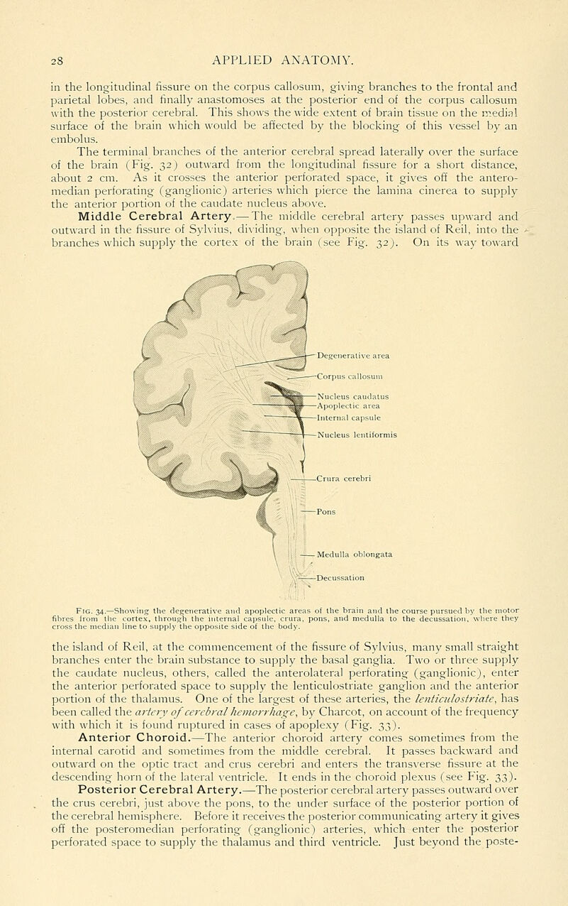 in the longitudinal fissure on the corpus callosum, giving branches to the frontal and parietal lobes, and finally anastomoses at the posterior end of the corpus callosum with the posterior cerebral. This shows the wide extent of brain tissue on the medi.-?! surface of the brain which would be affected by the blocking of this vessel by an embolus. The terminal branches of the anterior cerebral spread laterally over the surface of the brain (Fig. 32j outward from the longitudinal fissure for a short distance, about 2 cm. As it crosses the anterior perforated space, it gives off the antero- median perforating rganglionic) arteries which pierce the lamina cinerea to supply the anterior portion of the caudate nucleus above. Middle Cerebral Artery,— The middle cerebral artery passes upward and outward in the fissure of Sylvius, di\dding, when opposite the island of Reil, into the branches which supply the cortex of the brain (see Fig. 32). On its way toward . Medulla oblongata ,'^ Decussation Fig. 34.—Showing the degenerative and apoplectic areas of the brain and the course pursued by the motor fibres from the corte-x, through the internal capsule, crura, pons, and medulla to the decussation, where they cross the median line to supply the opposite side of the body. the island of Reil, at the commencement of the fissure of Sylvius, many small straight branches enter the brain substance to supply the basal ganglia. Two or three supply the caudate nucleus, others, called the anterolateral perforating (ganglionic), enter the anterior perforated space to supply the lenticulostriate ganglion and the anterior portion of the thalamus. One of the largest of these arteries, the lenticulostriate, has been called the artery of cerebral hemorrhage, by Charcot, on account of the frequency with which it is found ruptured in cases of apoplexy (Fig. 33). Anterior Choroid.—The anterior choroid artery comes sometimes from the internal carotid and sometimes from the middle cerebral. It passes backward and outward on the optic tract and crus cerebri and enters the transverse fissure at the descending horn of the lateral ^'entricle. It ends in the choroid plexus (see Fig. 33). Posterior Cerebral Artery.—The posterior cerebral artery passes outward over the crus cerebri, just above the pons, to the under surface of the posterior portion of the cerebral hemisphere. Before it receives the posterior communicating artery it gives off the posteromedian perforating (ganglionic) arteries, which enter the posterior perforated space to supply the thalamus and third ventricle. Just beyond the poste-