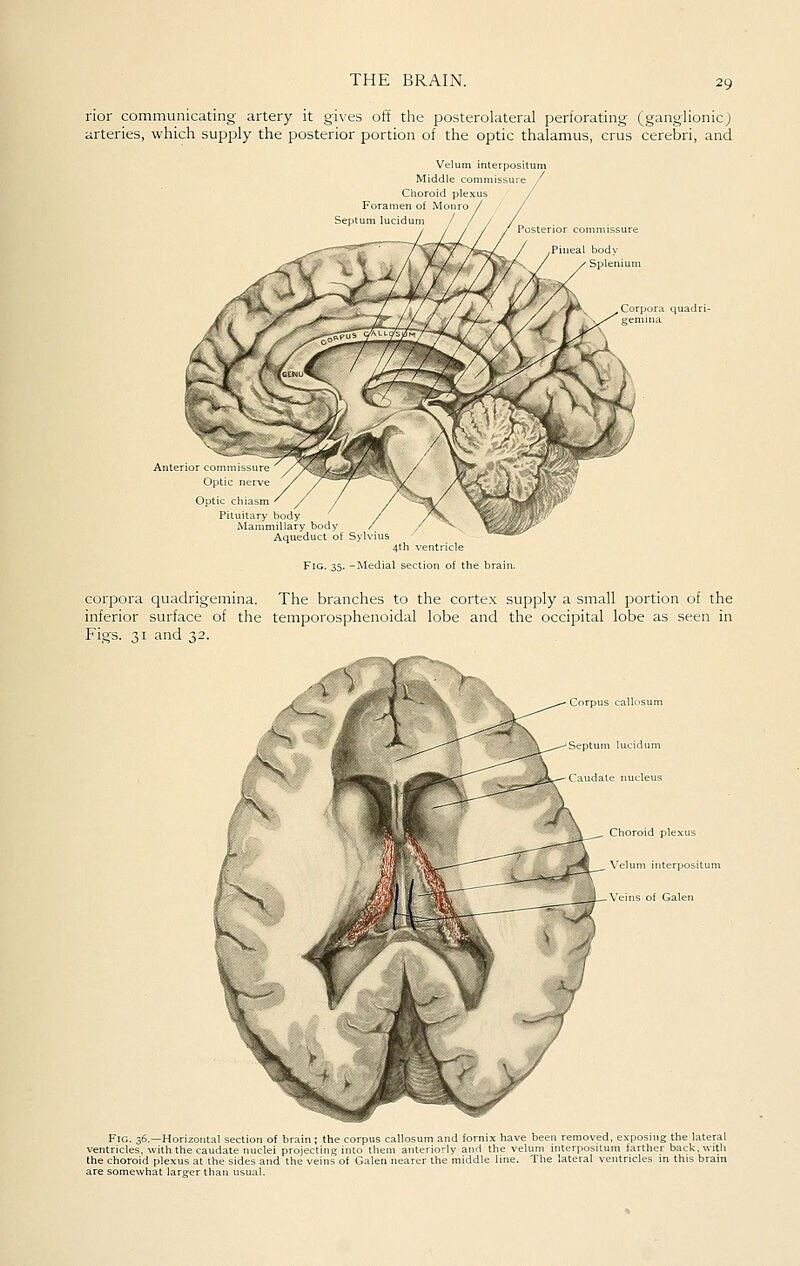 rior communicating artery it gives off the posterolateral perforating (ganglionic) arteries, which supply the posterior portion of the optic thalamus, crus cerebri, and Uptl Ootic ch Middle Choroid pie Foramen of Mo Septum lucidum / Velum interpositum Pituitary body Mammillary body Aqueduct of Sylvius 4th ventricle Fig. 35. -Medial section of the br; corpora quadrigemina. The branches to the cortex supply a small portion of the inferior surface of the temporosphenoidal lobe and the occipital lobe as seen in Figs. 31 and 32. ^, Fig. 36.—Horizontal section of brain; the corpus callosum and forni.x have been removed, exposing the lateral ventricles, with the caudate nuclei projecting into them anteriorly and the velum interpositum farther back, with the choroid plexus at the sides and the veins of Galen nearer the middle line. The lateral ventricles in this brain are somewhat larger than usual.