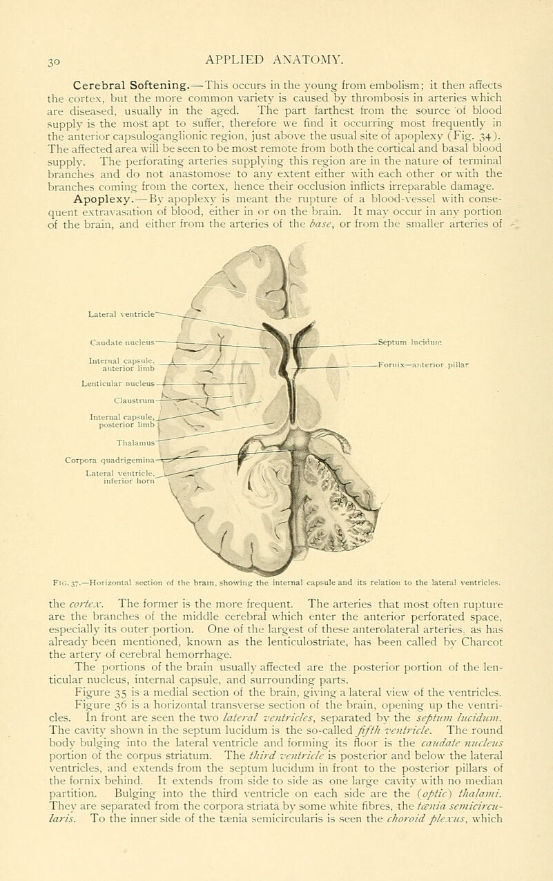 Cerebral Softening.—This occurs in the young from emboHsm; it then affects the cortex, but the more common variety is caused by thrombosis in arteries which are diseased, usually in the aged. The part farthest from the source of blood supply is the most apt to suft'er, therefore we find it occurring most frequently in the anterior capsuloganglionic region, just above the usual site of apoplexy (Fig. 34). The affected area will be seen to be most remote from both the cortical and basal blood supply. The perforating arteries supplying this region are in the nature of terminal branches and do not anastomose to any extent either with each other or with the branches coming from the cortex, hence their occlusion inflicts irreparable damage. Apoplexy.—By apoplexy is meant the rupture of a blood-vessel with conse- quent extravasation of blood, either in or on the brain. It mav occur in anv portion of the brain, and either from the arteries of the Sase, or from the smaller arteries of Lateral ventricle Caudate nucleus Lenticular nucl Claustrum Interna! capsul _ posterior limb ; Corpora quadrig Septum luciriuin Fonii.x—anterior pilla Fig.37.—Horizontal section of the brain, showing the internal capsule and its relation to the lateral ventricles. the co)-te.x. The former is the more frequent. The arteries that most often rupture are the branches of the middle cerebral which enter the anterior perforated space, especially its outer portion. One of the largest of these anterolateral arteries, as has already been mentioned, known as the lenticulostriate, has been called bv Charcot the artery of cerebral hemorrhage. The portions of the brain usually affected are the posterior portion of the len- ticular nucleus, internal capsule, and surrounding parts. Figure 35 is a medial section of the brain, giving a lateral view of the ventricles. Figure 36 is a horizontal transverse section of the brain, opening up the ventri- cles. In front are seen the two lateral ventricles, separated bv the septum lucidum. The cavitv shown in the septum lucidum is the so-called^/?// ventricle. The round body bulging into the lateral ^•entricle and forming its floor is the caudate niiclciis portion of the corpus striatum. The third ventricle is posterior and below the lateral ventricles, and extends from the septum lucidum in front to the posterior pillars of the forni.x behind. It extends from side to side as one large cavity with no median partition. Bulging into the third ventricle on each side are the (optic^ tlialami. They are separated from the corpora striata by some white fibres, the tcsnia semicircu- laris. To the inner side of the taenia semicircularis is seen the choroid plexus, whicli