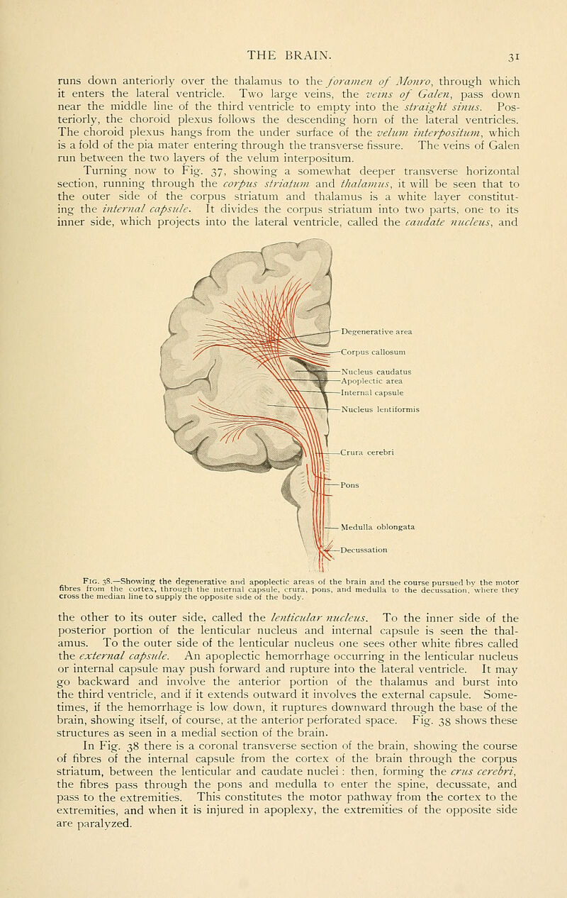 runs down anteriorly over the thalamus to the foramen of Monro, through which it enters the lateral ventricle. Two large veins, the vems of Galen, pass down near the middle line of the third \entricle to empty into the straight simcs. Pos- teriorly, the choroid plexus follows the descending- horn of the lateral ventricles. The choroid ple.xus hangs from the under surface of the velum interpositum, which is a fold of the pia mater entering through the transverse fissure. The veins of Galen run between the two layers of the velum interpositum. Turning now to Fig. 37, showing a somewhat deeper transverse horizontal section, running through the corpus striatum and thalamus, it will be seen that to the outer side of the corpus striatum and thalamus is a white layer constitut- ing the internal capsule. It divides the corpus striatum into two parts, one to its inner side, which projects into the lateral ventricle, called the caudate nucleus, and Fig. 38.—! fibres from the cross the mediai howing the degenerative and apoplectii corte.^, throu,o;h the internal capsule, c line to supply the opposite side of the body. the other to its outer side, called the lenticular nucleus. To the inner side of the posterior portion of the lenticular nucleus and internal capsule is seen the thal- amus. To the outer side of the lenticular nucleus one sees other white fibres called the external capsule. An apoplectic hemorrhage occurring in the lenticular nucleus or internal capsule may push forward and rupture into the lateral ventricle. It may go backward and involve the anterior portion of the thalamus and burst into the third ventricle, and if it extends outward it involves the external capsule. Some- times, if the hemorrhage is low down, it ruptures downward through the base of the brain, showing itself, of course, at the anterior perforated space. Fig. 38 shows these structures as seen in a medial section of the brain. In Fig. 38 there is a coronal transverse section of the brain, showing the course of fibres of the internal capsule from the cortex of the brain through the corpus striatum, between the lenticular and caudate nuclei : then, forming the cms cerebri, the fibres pass through the pons and medulla to enter the spine, decussate, and pass to the extremities. This constitutes the motor pathway from the cortex to the extremities, and when it is injured in apoplexy, the e.xtremities of the opposite side are paralyzed.