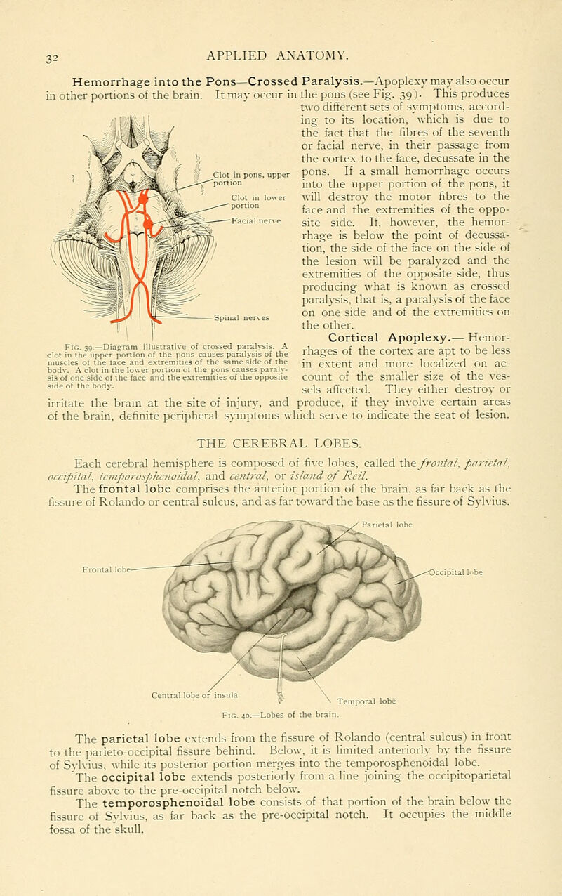 in other portions of the brain. APPLIED ANATOMY. Hemorrhage into the Pons—Crossed Paralysis.—Apoplexy may also occur It may occur in the pons (^see Fig. 39 ). This produces two different sets of symptoms, accord- ing to its location, which is due to the fact that the fibres of the seventh or facial ner\-e, in their passage from the cortex to the face, decussate in the pons. If a small hemorrhage occurs into the upper portion of the pons, it ■will destroy the motor fibres to the face and the extremities of the oppo- site side. If, however, the hemor- rhage is below the point of decussa- tion, the side of the face on the side of the lesion will be paralyzed and the extremities of the opposite side, thus producing what is known as crossed paralysis, that is, a paralysis of the face on one side and of the extremities on the other. Cortical Apoplexy.— Hemor- Fic. 39—Diagram illustrative of crossed paralysis. A ^l-acTPs of thf rr.rtpv arp ant to he IPS'; clot in the upper portion of the pons causes paralysis of the rnages OX tne COrteX are apt tO DC iCbb muscles of the face and extremities of the same side of the Jj^ extent and more localized On ac- bodv. A clot in the lower portion ot the pons causes paralv- . ,, . . . sis of one side of the face and the extremities of the opposite COUnt of the Smaller Size Of the VCS- sideofthebody. sels affected. They either destroy or irritate the brain at the site of injury, and produce, if they in\-olve certain areas of the brain, definite peripheral symptoms which ser\ e to indicate the seat of lesion. THE CEREBRAL LOBES. Each cerebral hemisphere is composed of fi\-e lobes, called the froiital, parietal, occipital, tcii!po)'osplicnoidaI, saxA central, o\- island of Reil. The frontal lobe comprises the anterior portion of the brain, as far back as the fissure of Rolando or central sulcus, and as far toward the base as the fissure of Sylvius. piial Icbe Temporal lobe Lobes of the brain. The parietal lobe extends from the fissure of Rolando (central sulcus) in front to the parieto-occipital fissure behind. Below, it is limited anteriorly by the fissure of Sylvius, while its posterior portion merges into the temporosphenoidal lobe. The occipital lobe extends posteriorly from a line joining the occipitoparietal fissure abo\-e to the pre-occipital notch below. The temporosphenoidal lobe consists of that portion of the brain below the fissure of Svlvius, as far back as the pre-occipital notch. It occupies the middle fossa of the skull.