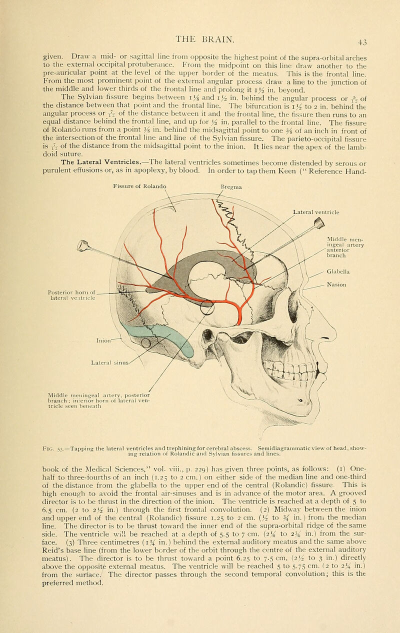 43 given. Draw a mid- or sagittal line from opposite the highest point of the supra-orbital arclies to the e.xternal occipital iirotiiberance. From the midpoint on this line draw another to the pre-auricular point at the level of the upper border of the meatus. This is the frontal line. From the most prominent point of the external angular process draw a line to tlie junction of the middle and lower thirds of the frontal line and prolong; it jyi in. beyond. The Sylvian fissure begins between lYs and ij/, in. behind the angular process or -j^r of the distance between that point and the frontal line. The bifurcation is i}4 to 2 in. behind the angular process or ^.j of the distance between it and the frontal line, the fissure then runs to an equal distance behind the frontal line, and up for yi in. parallel to the frontal line. The fissure of Rolando runs from a point Y^ in. behind the midsagittal point to one % of an inch in front of the intersection of the frontal line and line of the Sylvian fissure. The parieto-occipital fissure is ,\ of the distance from the midsagittal point to the inion. It lies near the ape.x of the lamb- doid suture. The Lateral Ventricles.—The lateral ventricles sometimes become distended by serous or purulent effusions or, as in apoplexy, by blood. In order to tap them Keen { Reference Hand- Fissure of Rolando ^m^> Middle meningeal artery, posterior branch ; Inierior horn of lateral ven- tricle seen beneath -Tapping the lateral ^ ;ntricles and trephining for cerebral abscess. Semidi; ng relation of Rolandic and Sylvian fissures and lines / of head. show- book of the Medical Sciences, vol. viii., p. 229) has given three points, as follows: (i) One- half to three-fourths of an inch (1.25 to 2 cm.) on either side of the median line and one-third of the distance from the glabella to the upper end of the central (Rolandic) fissure. This is high enougli to avoid the frontal air-sinuses and is in advance of the motor area. A grooved director is lo be thrust in the direction of the inion. The ventricle is reached at a depth of 5 to 6.5 cm. {2 to 2'X in.) through the first frontal convolution. (2) Midway between the inion and upper end of the central (Rolandic) fissure 1.25 to 2 cm. {yi to }( in.) from the median line. The director is to be thrust toward the inner end of the supra-orbital ridge of the same side. The ventricle will be reached at a depth of 5.5 to 7 cm. (2% to 2^ in.) from the sur- face. (3) Three centimetres {1% in.) behind the external auditory meatus and the same above Reid's base line (from the lower border of the orbit through the centre of the external auditory meatus). The director is to be thrust toward a point 6.25 to 7.,5 cm. (24 to 3 in.) directly above the opposite external meatus. The ventricle will be reached 5 to 5.75 cm. (2 to 2'4 in.) from the surface. The director passes through the second temporal convolution; this is the preferred method.