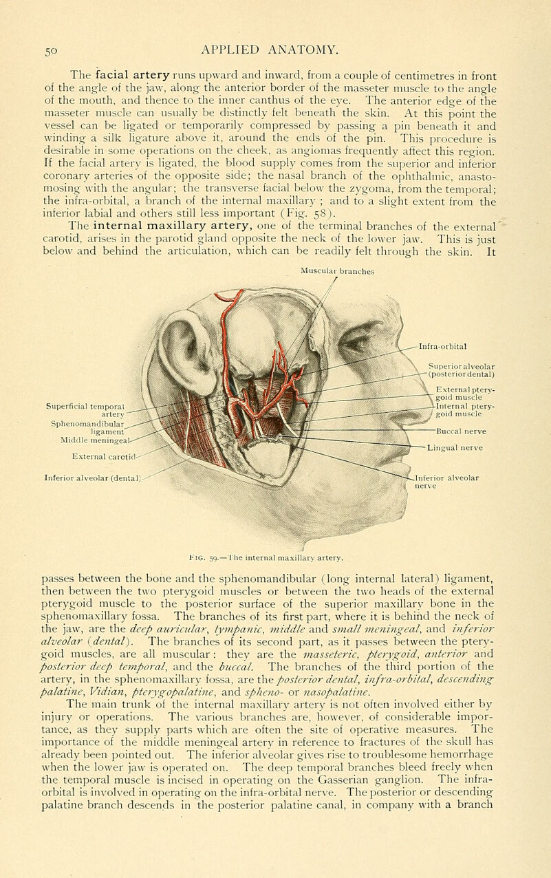 The facial artery runs upward and inward, from a couple of centimetres in front of the angle of the jaw, along the anterior border of the masseter muscle to the angle of the mouth, and thence to the inner canthus of the eye. The anterior edge of the masseter muscle can usually be distinctly felt beneath the skin. At this point the vessel can be ligated or temporarily compressed by passing a pin beneath it and winding a silk ligature above it, around the ends of the pin. This procedure is desirable in some operations on the cheek, as angiomas frequently affect this region. If the facial arter}' is ligated, the blood supply comes from the superior and inferior coronary arteries of the opposite side; the nasal branch of the ophthalmic, anasto- mosing with the angular; the transverse facial below the zygoma, from the temporal; the infra-orbital, a branch of the internal ma.xillary ; and to a slight extent from the inferior labial and others still less important (Fig. 58). The internal maxillary artery, one of the terminal branches of the external carotid, arises in the parotid gland opposite the neck of the lower jaw. This is just below and behind the articulation, which can be readily felt through the skin. It Muscular branches Infra-orbital uperioralveolar (posterior dental) Superficial temporal artery Spbenomaiidibular ligament' Middle meninq-eE External carotid' Inferior alveolar (dental) hlG. 59.— Ihe internal maxillary artery. passes between the bone and the sphenomandibular (long internal lateral) ligament, then between the two pterygoid muscles or between the two heads of the external pterygoid muscle to the posterior surface of the superior maxillary bone in the sphenomaxillary fossa. The branches of its first part, where it is behiiid the neck of the jaw, are the deep auricular, tympanic, middle and small meningeal, and inferior alveolar {dental). The branches of its second part, as it passes between the ptery- goid muscles, are all muscular : they are the masseteric, pterygoid, anterior and posterior deep temporal, and the buccal. The branches of the third portion of the artery, in the sphenomaxillary fossa, 2.re the posterior dental, infra-orbital, descending palatine. Vidian, pterygopalatine, and spheno- or nasopalatine. The main trunk of the internal maxillary artery is not often involved either by injury or operations. The various branches are, however, of considerable impor- tance, as they supply parts which are often the site of operative measures. The importance of the middle meningeal artery in reference to fractures of the skull has already been pointed out. The inferior alveolar gives rise to troublesome hemorrhage when the lower jaw is operated on. The deep temporal branches bleed freely when the temporal muscle is incised in operating on the Gasserian ganglion. The infra- orbital is involved in operating on the infra-orbital nerve. The posterior or descending palatine branch descends in the posterior palatine canal, in company with a branch