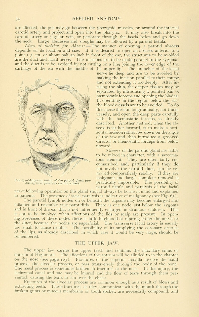 are affected, the pus may go between the pterygoid muscles, or around the internal carotid artery and project and open into the pharynx. It may also break into the carotid artery or jugular vein, or perforate through the fascia below and go down the neck. Large abscesses and sloughs may be followed b_v a parotid fistula. Lines of Incision fo?- Abscess.—The manner of opening a parotid abscess depends on its location and size. If it is desired to open an abscess anterior to a point 1.5 cm. or about half an inch in front of the ear, the structures to be avoided are the duct and facial nerve. The incisions are to be made parallel to the zygoma, and the duct is to be avoided by not cutting on a line joining the lower edge of the cartilage of the ear with the middle of the upper lip. The branches of the facial nerve lie deep and are to be avoided by making the incision parallel to their course,. and not extending it too deeply. After in- cising the skin, the deeper tissues may be separated by introducing a pointed pair of haemostatic forceps and opening the blades. In o])erating in the region below the ear, the blood-vessels are to be avoided. To do this incise the skin longitudinally, not trans- \'ersely, and open the deep parts carefully with the hfemostatic forceps, as already described. Another method, when the ab- scess is farther forward, is to make a hori- zontal incision rather low down on the angle of the jaw and then introduce a grooved director or hEemostatic forceps from below upward. Tumors of the parotid gland are liable to be mixed in character, with a sarcoma- tous element. They are often fairly cir- cumscribed and, particularly if they do not involve the parotid duct, can be re- mo\'ed comparati\'ely readily. If they are malignant and large, complete removal is practically impossible. The possibilit}' of parotid fistula and paralysis of the facial nerve following operation on this gland should always be borne in mind and explained to patients. The presence of facial paralysis is indicative of malignancy (see Fig. 63). The parotid lymph nodes on or beneath the capsule may become enlarged and inflamed and resemble true parotiditis. There is one node just below the zygoma and in front of the ear that is not infrequently enlarged in strumous children. This is apt to be involved when affections of the lids or scalp are present. In open- ing abscesses of these nodes there is little likelihood of injuring either the nerve or the duct, because the nodes are superficial. The transverse facial artery is usually too small to cause trouble. The possibility of its supplying the coronary arteries of the lips, as already described, in which case it would be verj' large, should be remembered. THE UPPER JAW. The upper jaw carries the upper teeth and contains the maxillar)- sinus or antrum of Highmore. The affections of the antrum will be alluded to in the chapter on the nose (see page 103). Fractures of the superior maxilla involve the nasal process, the ah'eolar process, or pass trans\-ersely through the body of the bone. The nasal process is sometimes broken in fractures of the nose. In this injury, the lachrymal canal and sac may be injured and the flow of tears through them pre- vented, causing the tears to run over the cheek. Fractures of the ah'eolar process are common enough as a result of blows and e.xtracting teeth. These fractures, as they communicate with the mouth through the broken gums or mucous membrane or tooth socket, are necessarily compound, and -Malignant tumor of the parotid gland pro- lucing facial paralysis (author's case).