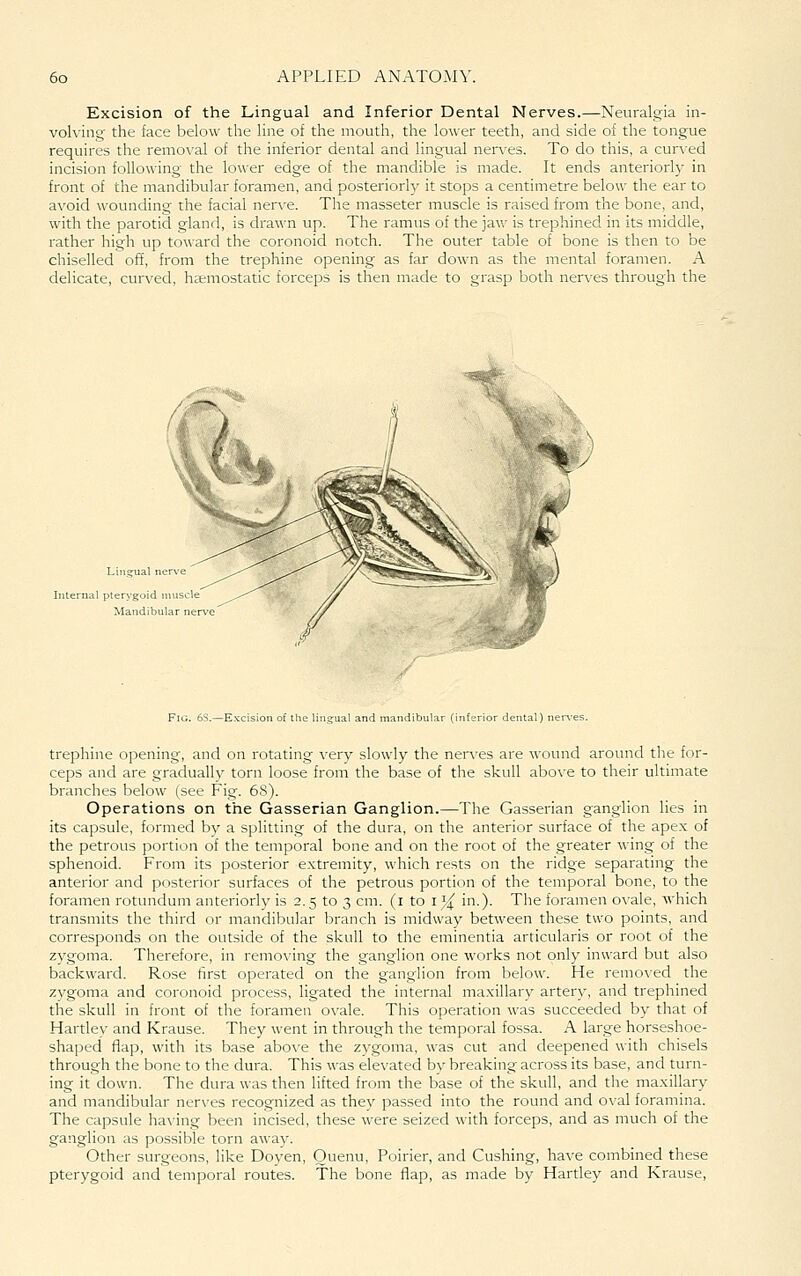 Excision of the Lingual and Inferior Dental Nerves.—Neuralgia in- volving the face below the line of the mouth, the lower teeth, and side of the tongue requires the removal of the inferior dental and lingual nerves. To do this, a curved incision following the lower edge of the mandible is made. It ends anteriorly in front of the mandibular foramen, and posteriorh^ it stops a centimetre below the ear to avoid wounding the facial nen^e. The masseter muscle is raised from the bone, and, with the parotid gland, is drawn up. The ramus of the jaw is trephined in its middle, rather high up toward the coronoid notch. The outer table of bone is then to be chiselled off, from the trephine opening as far down as the mental foramen. A delicate, cun^ed, hsemostatic forceps is then made to grasp both ner\'es through the Internal pterygoid Mandibu Fig. 6S.—Excis ndibular (inferior dental) i trephine opening, and on rotating very slowly the nerves are wound around the for- ceps and are gradually torn loose from the base of the skull above to their ultimate branches below (see Fig. 68). Operations on the Gasserian Ganglion.—The Gasserian ganglion lies in its capsule, formed by a splitting of the dura, on the anterior surface of the apex of the petrous portion of the temporal bone and on the root of the greater wing of the sphenoid. From its posterior extremity, which rests on the ridge separating the anterior and posterior surfaces of the petrous portion of the temporal bone, to the foramen rotundum anteriorly is 2.5 to 3 cm. (1 to i}( in.). The foramen ovale, Avhich transmits the third or mandibular branch is midway between these two points, and corresponds on the outside of the skull to the eminentia articularis or root of the zygoma. Therefore, in removing the ganglion one works not only inward but also backward. Rose first operated on the ganglion from below. He removed the zygoma and coronoid process, ligated the internal maxillar_v artery, and trephined the skull in front of the foramen ovale. This operation was succeeded by that of Hartley and Krause. They went in through the temporal fossa. A large horseshoe- shaped flap, with its base abo\'e the zygoma, was cut and deepened with chisels through the bone to the dura. This was elevated by breaking across its base, and turn- ing it down. The dura was then lifted from the base of the skull, and the maxillary and mandibular nerves recognized as they passed into the round and oval foramina. The capsule having been incised, these were seized with forceps, and as much of the ganglion as possible torn away. Other surgeons, like Doyen, Ouenu, Poirier, and Gushing, have combined these pterygoid and temporal routes. The bone flap, as made by Hardey and Krause,