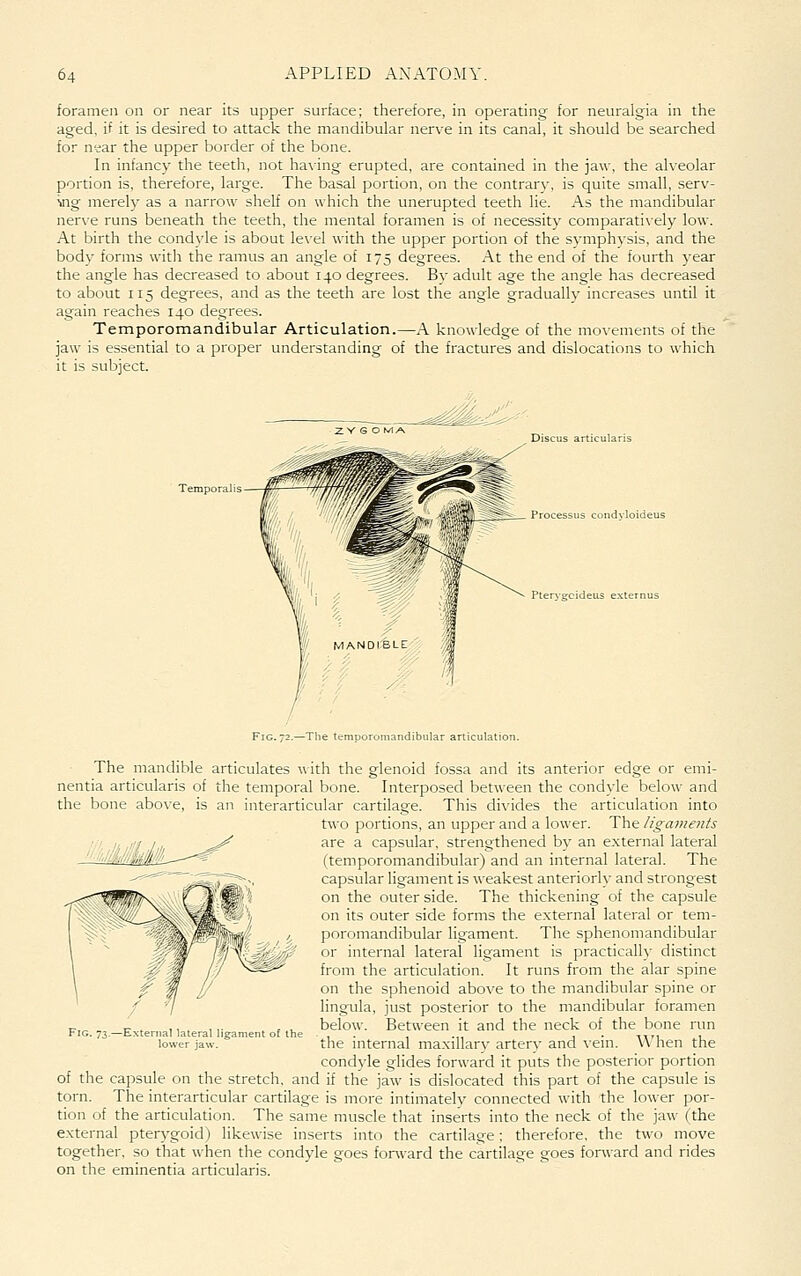 foramen on or near its upper surface; therefore, in operating for neuralgia in the aged, if it is desired to attack the mandibular nerve in its canal, it should be searched for n-ear the upper border of the bone. In infancy the teeth, not having erupted, are contained in the jaw, the alveolar portion is, therefore, large. The basal portion, on the contrary, is quite small, serv- ing merely as a narrow shelf on which the unerupted teeth lie. As the mandibular ner\-e runs beneath the teeth, the mental foramen is of necessity comparati\-ely low. At birth the condyle is about le\el with the upper portion of the symphvsis, and the bod}' forms with the ramus an angle of 175 degrees. At the end of the fourth year the angle has decreased to about 140 degrees. By adult age the angle has decreased to about 115 degrees, and as the teeth are lost the angle gradually increases until it again reaches 140 degrees. Temporomandibular Articulation.—A knowledge of the movements of the jaw is essential to a proper understanding of the fractures and dislocations to which it is subject. Temporalis Discus articularis Processus condvloideus Pterygcideus externu Fig. 72.—The temporomandibular articulation. The mandible articulates ^^•ith the glenoid fossa and its anterior edge or emi- nentia articularis of the temporal bone. Interposed between the condyle below and the bone above, is an interarticular cartilage. This divides the articulation into two portions, an upper and a lower. The ligaments are a capsular, strengthened b}' an external lateral (temporomandibular) and an internal lateral. The capsular ligament is weakest anteriorly and strongest on the outer side. The thickening of the capsule on its outer side forms the external lateral or tem- poromandibular ligament. The sphenomandibular or internal lateral ligament is practically distinct from the articulation. It runs from the alar spine on the sphenoid above to the mandibular spine or lingula, just posterior to the mandibular foramen below. Between it and the neck of the bone ran the internal maxillary artery and vein. When the condyle glides forward it puts the posterior portion of the capsule on the stretch, and if the jaw is dislocated this part of the capsule is torn. The interarticular cartilage is more intimately connected with the lower por- tion of the articulation. The same muscle that inserts into the neck of the jaw (the external pterygoid) likewise inserts into the cartilage; therefore, the two move together, so that when the condyle goes forward the cartilage goes forward and rides on the eminentia articularis. Fig. 73.—E.vterual lateral ligament of the lower jaw.