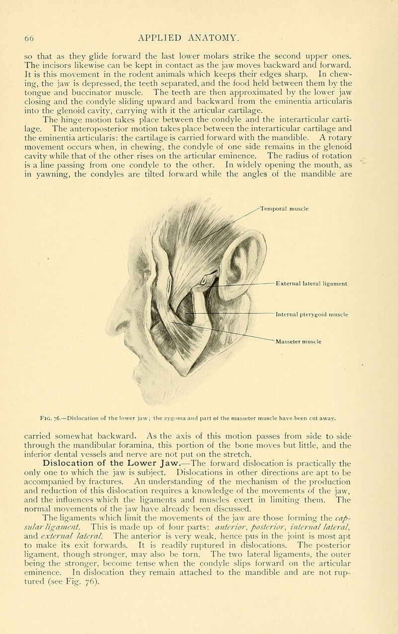 so that as they ghde forward the last lower molars strike the second upper ones. The incisors likewise can be kept in contact as the jaw moves backward and forward. It is this movement in the rodent animals which keeps their edges sharp. In chew- ing, the jaw is depressed, the teeth separated, and the food held between them by the tongue and buccinator muscle. The teeth are then approximated by the lower jaw closing and the condyle sliding upward and backward from the eminentia articularis into the glenoid cavity, carrying with it the articular cartilage. The hinge motion takes place between the condyle and the interarticular carti- lage. The anteroposterior motion takes place between the interarticular cartilage and the eminentia articularis: the cartilage is carried forward with the mandible. A rotary movement occurs when, in chewing, the condyle of one side remains in the glenoid cavity while that of the other rises on the articular eminence. The radius of rotation is a line passing from one condyle to the other. In widely opening the mouth, as in yawning, the condyles are tilted forward while the angles of the mandible are Temporal muscle External lateral ligament Internal pterygoid muscle Masseter muscle Fig. 76.—Dislocation of the lower jaw; the zygitma and part of the masseter muscle have been cut away. carried somewhat backward. As the a.xis of this motion passes from side to side through the mandibular foramina, this portion of the bone moves but little, and the inferior dental vessels and nerve are not put on the stretch. Dislocation of the Lower Jaw.—The forward dislocation is practically the only one to which the jaw is subject. Dislocations in other directions are apt to be accompanied by fractures. An understanding of the mechanism of the production and reduction of this dislocation requires a knowledge of the movements of the jaw, and the influences which the ligaments and muscles exert in limiting them. The normal movements of the jaw have already been discussed. The ligaments which hmit the movements of the jaw are those forming the cap- sular ligament. This is made up of four parts: anterior, posterior, internal lateral, and external lateral. The anterior is very weak, hence pus in the joint is most apt to make its exit forwards. It is readily ruptured in dislocations. The posterior ligament, though stronger, may also be torn. The two lateral ligaments, the outer being the stronger, become tense when the condyle slips forward on the articular eminence. In dislocation they remain attached to the mandible and are not rup- tured (see Fig. 76).