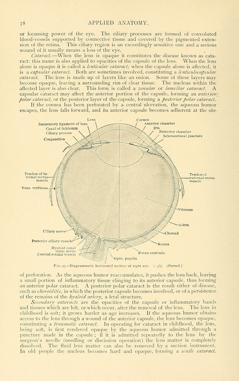 or focussing power of the eye. The ciHary processes are formed of convoluted blood-vessels supported by connective tissue and covered by the pigmented exten- sion of the retina. This ciliary region is an exceedingly sensitive one and a serious wound of it usually means a loss of the eye. Catai'ad.—When the lens is opaque it constitutes the disease known as cata- ract: this name is also applied to opacities of the capsule of the lens. When the lens alone is opaque it is called a lenticular cataract; when the capsule alone is affected, it is a capsular cataract. Both are sometimes involved, constituting a lenticulocapsidar cataract. The lens is made up of layers like an onion. Some of these layers may become opaque, leaving a surrounding rim of clear tissue. The nucleus within the affected layer is also clear. This form is called a zonular or lamellar cataract. A capsular cataract may affect the anterior portion of the capsule, forming an anterior polcvr cataract, or the posterior layer of the capsule, forming a poste7'ior polar cataract. If the cornea has been perforated by a central ulceration, the aqueous humor escapes, the lens falls forward, and its anterior capsule becomes adherent at the site Suspensory ligament of lens Canal of Scilemm Ciliary process Conjunctiva Cornea Anterior chamber Iris Posterior chamber Sclerocorneal juncture Tendon of in- ternal rectus muscle Vena vorticosa Hyaloid Optic Central retinal \ ,/yj / Optic papilla . 93.—Diagrammatic honzont-^l section of right eye Rttiua centralis X 3^2. (Piersol.) of perforation. As the aqueous humor reaccumulates, it pushes the lens back, leaving a small portion of inflammatory tissue clinging to its anterior capsule, thus forming an anterior polar cataract. A posterior polar cataract is the result either of disease, such as choroiditis, in which the posterior capsule becomes involved, or of a persistence of the remains of the hyaloid a?'tery, a fetal structure. Secondary cataracts are the opacities of the capsule or inflammatory bands and tissues which are left, or which occur, after the removal of the lens. The lens in childhood is soft; it grows harder as age increases. If the aqueous humor obtains access to the lens through a wound of the anterior capsule, the lens becomes opaque, constituting a traumatic catai'act. In operating for cataract in childhood, the lens, being soft, is first rendered opaque by the aqueous humor admitted through a puncture made in the capsule ; if it is admitted repeatedly to the lens by the surgeon's needle (needhng or discission operation) the lens matter is completely dissolved. The fluid lens matter can also be remo\'ed by a suction instrument. In old people the nucleus becomes hard and opaque, forming a senile cataract.