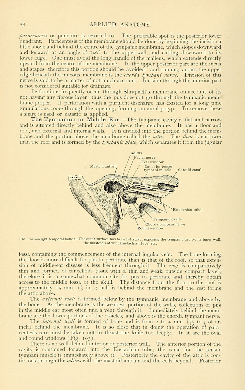pa}-acenfesis or puncture is resorted to. The preferable spot is the posterior lower quadrant. Paracentesis of the membrane should be done by beginning the incision a little above and behind the centre of the tympanic membrane, which slopes downward and forA\-ard at an angle of 140° to the upper wall, and cutting downward to its lower edge. One must avoid the long handle of the malleus, which extends directly upward from the centre of the membrane. In the upper posterior part are the incus and stapes, therefore this portion should be avoided; and running across the upper edge beneath the mucous membrane is the chorda tympani nerve. Division of this nerve is said to be a matter of not much account. Incision through the anterior part is not considered suitable for drainage. Perforations frequentl)- occur through Shrapnell's membrane on account of its not having any fibrous layer; thus the pus does not go through the tympanic mem'- brane proper. If perforation with a purulent discharge has existed for a long time granulations come through the opening, forming an aural polyp. To remove these a snare is used or caustic is applied. The Tympanum or Middle Ear.—The tympanic cavity is flat and narrow and is situated directly behind and also above the membrane. It has a floor and roof, and external and internal walls. It is divided into the portion behind the mem- brane and the portion abo\'e the membrane called the attic. The floor is narrower than the roof and is formed by the tympanic plate., which separates it from the jugular Aditus Facial i Oval window Canal for tensor t>mpani muscle Carotid canal Eustachian tube -Right temporal bone: -The outer snriace has been cut away, exposing the tympanic i the mastoid antrum. Eustachian tube, etc. fossa containing the commencement of the internal jugular vein. The bone forming the floor is more difficult for pus to perforate than is that of the roof, so that exten- sion of middle-ear disease is less frequent through it. The roof is comparatively thin and formed of cancellous tissue with a thin and weak outside compact layer; therefore it is a somewhat common site for pus to perforate and thereby obtain access to the middle fossa of the skull. The distance from the floor to the roof is approximately 15 mm. {\ in.); half is behind the membrane and the rest forms the attic above. The exteinial wall is formed below by the tympanic membrane and above by the bone. As the membrane is the weakest portion of the walls, collections of pus in the middle ear most often find a vent through it. Immediately behind the mem- brane are the lower portions of the ossicles, and above is the chorda tvmpani nerve. The internal wall is formed of bone and is from 2 to 4 mm. (yV to \ of an inch) behind the membrane. It is so close that in doing the operation of para- centesis care must be taken not to thrust the knife too deeply. In it are the oval and round windows (Fig. 103). There is no well-defined anterior or posterior wall. The anterior portion of the cavity is continued forward into the Eustachian tube; the canal for the tensor tvmpani muscle is immediateh' abo\'e it. Posteriorly the cavity of the attic is con- tinuous through the aditus with the mastoid antrum and the cells beyond. Posterior