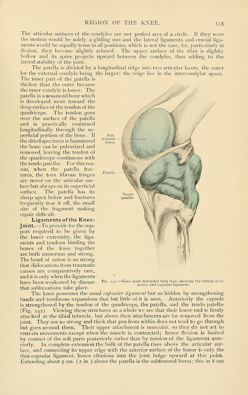 Sub femoiil bur The articular surfaces of the condyles are not perfect arcs of a circle. If they were the motion would be solely a gliding one and the lateral ligaments and crucial liga- ments would be equally tense in all positions, which is not the case, for, particularly in flexion, they become slightly relaxed. The upper surface of the tibia is slightly hollow and its spine projects upward between the condyles, thus adding to the lateral stability of the joint. The patella is divided by a longitudinal ridge into two articular facets, the outer for the external condyle being the larger; the ridge lies in the intercondylar space. The inner part of the patella is thicker than the outer because the inner condyle is lower. The patella is a sesamoid bone which is developed more toward the deep surface of the tendon of the quadriceps. The tendon goes over the surface of the patella and is practically continued longitudinally through the su- perficial portion of the bone. If the dried specimen is hammered the bone can be pulverized and removed, leaving the tendon of the quadriceps continuous with the tendo patellae. For this rea- son, when the patella frac- tures, the torn fibrous fringes are never on the articular sur- face but always on its superficial surface. The patella has its sharp ape.x below and fractures frequently tear it off, the small size of the fragment making repair difficult. Ligaments of the Knee- joint.—To provide for the sup- port required to be given by the lower extremity, the liga- ments and tendons binding the bones of the knee together are both numerous and strong. The bond of union is so strong that dislocations from traumatic causes are comparatively rare, and it is only when the ligaments have been weakened by disease that subluxations take place. The knee possesses the usual capsular ligament but so hidden by strengthening bands and tendinous expansions that but little of it is seen. Anteriorly the capsule is strengthened by the tendon of the quadriceps, the patella, and the tendo patellae (Fig. 545). Viewing these structures as a whole we see that their lower end is firmly attached at the tibial tubercle, but above their attachments are far removed from the joint. They are so strong and thick that pus from within does not tend to go through but goes around them. Their upper attachment is muscular, so they do not act to restrain movements except when the muscle is contracted; hence flexion is limited by contact of the soft parts posteriorly rather than by tension of the ligaments ante- riorly. In complete extension the bulk of the patella rises above the articular sur- face, and connecting its upper edge with the anterior surface of the femur is only the thin capsular ligament, hence effusions into the joint bulge upward at this point. Extencling about 5 cm. (2 in. ) above the patella is the subfemoral bursa; this in 8 out e-joint distended with wax, showing the extent of its cavity and capsular ligament.