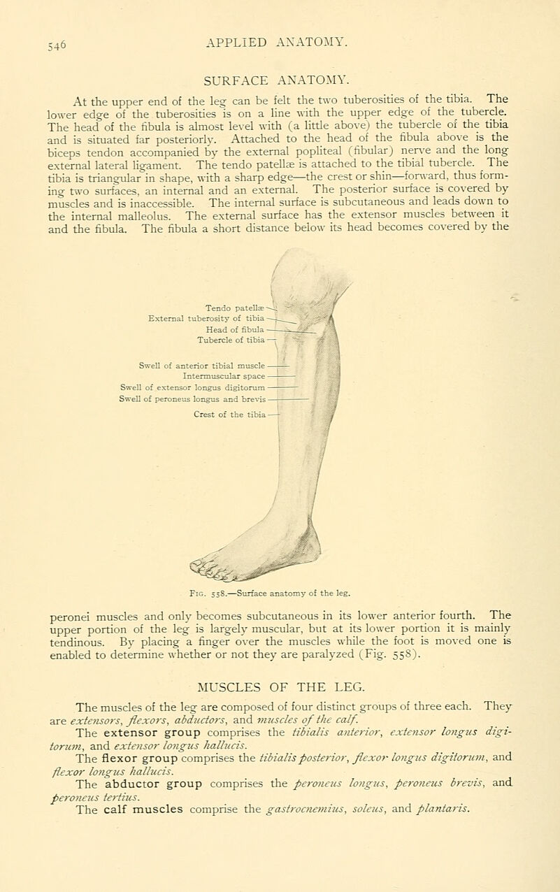 SURFACE ANATOMY. At the upper end of the leg can be felt the two tuberosities of the tibia. The lower edge of the tuberosities is on a line -srith the upper edge of the tubercle. The head of the fibula is almost lexd with (a little above) the tubercle of the tibia and is situated far posteriorly. Attached to the head of the fibula above is the biceps tendon accompanied by the external popliteal (fibular) ner\-e and the long external lateral ligament. The tendo patellae is attached to the tibial tubercle. The tibia is triangular in shape, with a sharp edge—the crest or shin—forward, thus form- ing tn'o surfaces, an internal and an external. The posterior surface is covered by muscles and is inaccessible. The internal surface is subcutaneous and leads down to the internal malleolus. The external surface has the extensor muscles bet^veen it and the fibula. The fibula a short distance below its head becomes covered by the Tendo pateli^ -^^ External tuberosity of tibia -—-. Head of fibula -— Tubercle of tibia —r Swell of anterior tibial muscle- Intermuscular space - Swell of extensor longus digitorum - Swell of peroneus longus and brevis - Crest of the tibia Fig. 55S.—Surface anatomy of thi peronei muscles and only becomes subcutaneous in its lower anterior fourth. The upper portion of the leg is largely muscular, but at its lower portion it is mainly tendinous. Bv placing a finger over the muscles while the foot is moved one is enabled to determine whether or not they are paralyzed (Fig. 55S). MUSCLES OF THE LEG. The muscles of the leg are composed of four distinct groups of three each. They are extensors, flexors, abductors, and muscles of the calf. The extensor group comprises the tibialis anterior, extensor longus digi- torum, and extensor longics hallucis. The flexor group comprises the tibialis posterior, flexor longus digitorum, and flexor longus hallucis. The abductor group comprises the pcj-oncus loyigus, peroneus brevis, and perojicus tertius. The calf muscles comprise the gasti-ocnemiics, soleus, and plantaris.