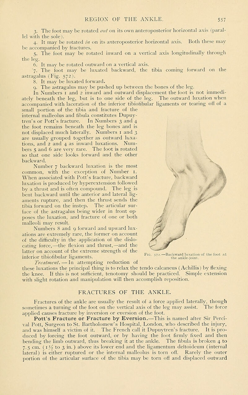 3. The foot may be rotated out on its own anteroposterior horizontal axis (paral- lel with the sole). 4. It may be rotated in on its anteroposterior horizontal axis. Both these may be accompanied by fractures. 5. The foot may be rotated in\\'ard on a vertical axis longitudinally through the leg. 6. It may be rotated outward on a vertical axis. '7. The foot may be luxated backward, the tibia coming forward on the astragalus (Fig. 572). 8. It may be luxated forward. 9. The astragalus may be pushed up between the bones of the leg. In Numbers i and 2 inward and outward displacement the foot is not immedi- ately beneath the leg, but is to one side of the leg. The outward lu.xation when accompanied with laceration of the inferior tibiofibular ligaments or tearing off of a small portion of the tibia and fracture of the internal malleolus and fibula constitutes Dupuy- tren's or Pott's fracture. In Numbers 3 and 4 the foot remains beneath the leg bones and is not displaced much laterally. Numbers i and 3 are usually grouped together as outward luxa- tions, and 2 and 4 as inward lu.xations. Num- bers 5 and 6 are very rare. The foot is rotated so that one side looks forward and the other backward. X Number 7 backward luxation is the most common, with the exception of Number i. When associated with Pott's fracture, backward luxation is produced by hyperextension followed by a thrust and is often compound. The leg is bent backward until the anterior and lateral lig- aments rupture, and then the thrust sends the tibia forward on the instep. The articular sur- face of the astragalus being wider in front op- poses the luxation, and fracture of one or both malleoli may result. Numbers 8 and 9 forward and upward lux- ations are extremely rare, the former on account of the ditSculty in the application of the dislo- cating force,—the flexion and thrust,—and the latter on account of the extreme strength of the inferior tibiofibular ligaments. Treatment. — In attempting reduction of these luxations the principal thing is to relax the tendo calcaneus (Achillis) by flexing the knee. If this is not sufficient, tenotomy should be practiced. Simple extension with slight rotation and manipulation will then accomplish reposition. i\^ FRACTURES OF THE ANKLE. Fractures of the ankle are usually the result of a force applied laterally, though sometimes a turning of the foot on the vertical axis of the leg may assist. The force applied causes fracture by inversion or eversion of the foot. Pott's Fracture or Fracture by Eversion.—This is named after Sir Perci- val Pott, Surgeon to St. Bartholomew's Hospital, London, who described the injury, and was himself a victim of it. The French call it Dupuytren's fracture. It is pro- duced by forcing the foot outward, or by ha^'ing the foot firmly fixed and then bending the hmb outward, thus breaking it at the ankle. The fibula is broken 4 to 7.5 cm. (1,^2 to 3 in.) above its lower end and the ligamentum deltoideum (internal lateral) is either ruptured or the internal malleolus is torn off. Rarely the outer portion of the articular surface of the tibia may be torn off and displaced outward