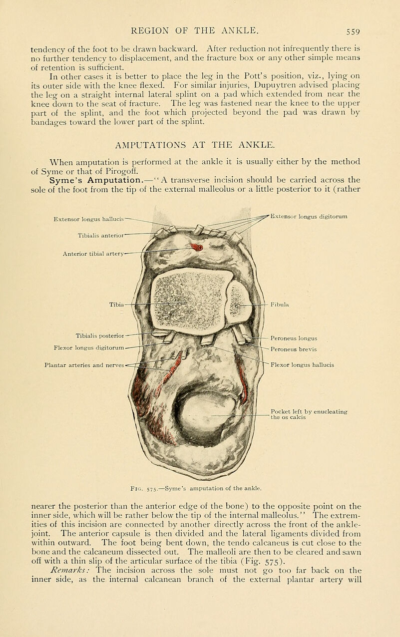 tendency of the foot to be drawn backward. After reduction not infrequently there is no further tendency to displacement, and the fracture box or any other simple means of retention is sufficient. In other cases it is better to place the leg in the Pott's position, viz., lying on its outer side with the knee flexed. For similar injuries, Dupuytren advised placing the leg on a straight internal lateral splint on a pad which extended from near the knee down to the seat of fracture. The leg was fastened near the knee to the upper part of the splint, and the foot which projected beyond the pad was drawn by bandages toward the lower part of the splint. AMPUTATIONS AT THE ANKLE. When amputation is performed at the ankle it is usually either by the method of Syme or that of Pirogoff. Syme's Amputation.—A transverse incision should be carried across the sole of the foot from the tip of the external malleolus or a little posterior to it (rather Extensor longus hall' Tibialis anterior Anterior tibial artery Tibialis posterioi Flexor longus digitorum Plantar arteries and nerves Extensor longus digitorum ^^' i— Peroneus longus V ^rV Peroneus brevis Flexor longus hallucis Fig. 575.—Syme's amputation of the ankle. nearer the posterior than the anterior edge of the bone) to the opposite point on the inner side, which will be rather below the tip of the internal malleolus. The extrem- ities of this incision are connected by another directly across the front of the ankle- joint. The anterior capsule is then divided and the lateral ligaments divided from within outward. The foot being bent down, the tendo calcaneus is cut close to the bone and the calcaneum dissected out. The malleoli are then to be cleared and sawn off with a thin slip of the articular surface of the tibia (Fig. 575). Rema7'ks: The incision across the sole must not go too far back on the inner side, as the internal calcanean branch of the external plantar artery will