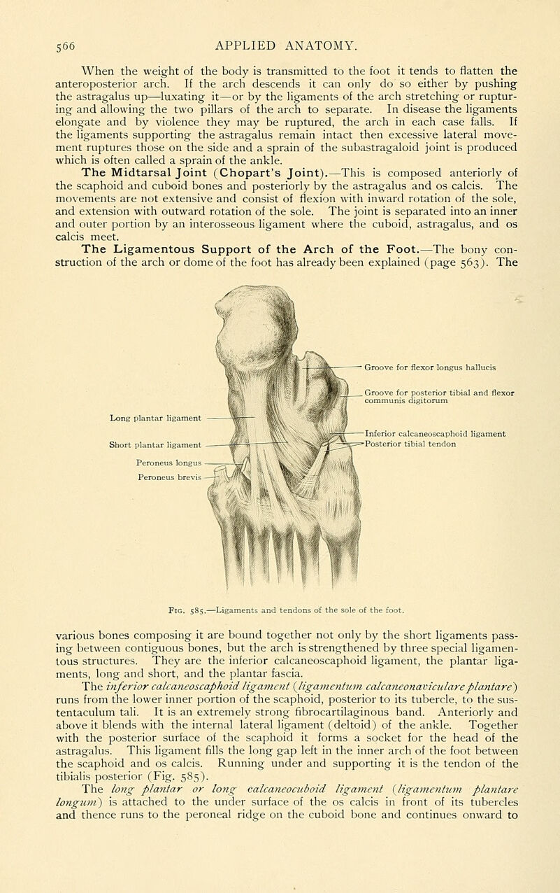 When the weight of the body is transmitted to the foot it tends to fiatten the anteroposterior arch. If the arch descends it can only do so either by pushing the astragalus up—luxating it—or by the ligaments of the arch stretching or ruptur- ing and allowing the two pillars of the arch to separate. In disease the ligaments elongate and by violence they may be ruptured, the arch in each case falls. If the ligaments supporting the astragalus remain intact then excessive lateral move- ment ruptures those on the side and a sprain of the subastragaloid joint is produced which is often called a sprain of the ankle. The Midtarsal Joint (Chopart's Joint).—This is composed anteriorly of the scaphoid and cuboid bones and posteriorly by the astragalus and os calcis. The movements are not extensive and consist of flexion with inward rotation of the sole, and extension with outward rotation of the sole. The joint is separated into an inner and outer portion by an interosseous ligament where the cuboid, astragalus, and os calcis meet. The Ligamentous Support of the Arch of the Foot.—The bony con- struction of the arch or dome of the foot has already been explained (page 563). The Long plantar ligament Short plantar ligament Peroneus longus Peroneus bre\ is Groove for flexor longus hallu Inferior calcaneoscaphoid ligament Posterior tibial tendon Fig. 585.—Ligaments and tendons of the sole of the foot. various bones composing it are bound together not only by the short ligaments pass- ing between contiguous bones, but the arch is strengthened by three special ligamen- tous structures. They are the inferior calcaneoscaphoid ligament, the plantar liga- ments, long and short, and the plantar fascia. The itiferior calcaneoscaphoid ligament (Jigamentum calcaneonavictdarepla.ntare') runs from the lower inner portion of the scaphoid, posterior to its tubercle, to the sus- tentaculum tali. It is an extremely strong fibrocartilaginous band. Anteriorly and above it blends with the internal lateral ligament (deltoid) of the ankle. Together with the posterior surface of the scaphoid it forms a socket for the head of the astragalus. This ligament fills the long gap left in the inner arch of the foot between the scaphoid and os calcis. Running under and supporting it is the tendon of the tibialis posterior (Fig. 585). The long plantar or long calcaneocuboid ligament (ligamentiim plantare longuni) is attached to the under surface of the os calcis in front of its tubercles and thence runs to the peroneal ridge on the cuboid bone and continues onward to