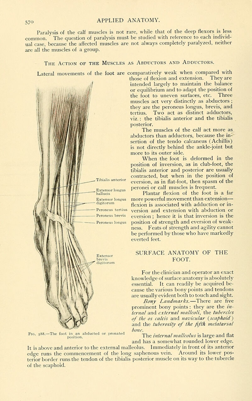 Paralysis of the calf muscles is not rare, while that of the deep flexors is less common. The question of paralysis must be studied with reference to each individ- ual case, because the affected muscles are not always completely paralyzed, neither are all the muscles of a group. The Action of the Muscles as Abductors and Adductors. Lateral movements of the foot are comparatively weak when compared with those of flexion and extension. They are intended largely to maintain the balance or equilibrium and to adapt the position of the foot to uneven surfaces, etc. Three muscles act very distinctly as abductors ; they are the peroneus longus, brevis, and tertius. Two act as distinct adductors, viz.: the tibialis anterior and the tibialis posterior. The muscles of the calf act more as abductors than adductors, because the in- sertion of the tendo calcaneus (AchilHs) is not directly behind the ankle-joint but more to its outer side. When the foot is deformed in the position of inversion, as in club-foot, the tibialis anterior and posterior are usually contracted, but when in the position of eversion, as in flat-foot, then spasm of the peronei or calf muscles is frequent. Plantar flexion of the foot is a far Extensor longus more powerful movement than extension— digitorum flexion is associated with adduction or in- Peroneus tertius yersion and extension with abduction or Peroneus brevis eversion ; hencc it is that inversion is the Peroneus longus position of Strength and eversion of weak- ness. Feats of strength and agility cannot IM be performed by those who have markedly everted feet. Tibialis anterior Extensor brevis digitorun SURFACE ANATOMY OF THE FOOT. For the clinician and operator an exact knowledge of surface anatomy is absolutely essential. It can readily be acquired be- cause the various bony points and tendons are usually evident both to touch and sight. Bony Laiidmarks.—There are five prominent bony points : they are the iti- ternal and external malleoli, the tubercles of the OS Calais and navicular (^scaphoid) and the tuberosity of the fifth metatarsal bone. late 'Y\\z inter7ial malleolus is large and flat and has a somewhat rounded lower edge. It is above and anterior to the external malleolus. Immediately in front of its anterior edge runs the commencement of the long saphenous vein. Around its lower pos- terior border runs the tendon of the tibialis posterior muscle on its way to the tubercle of the scaphoid. -The foot in an abducted