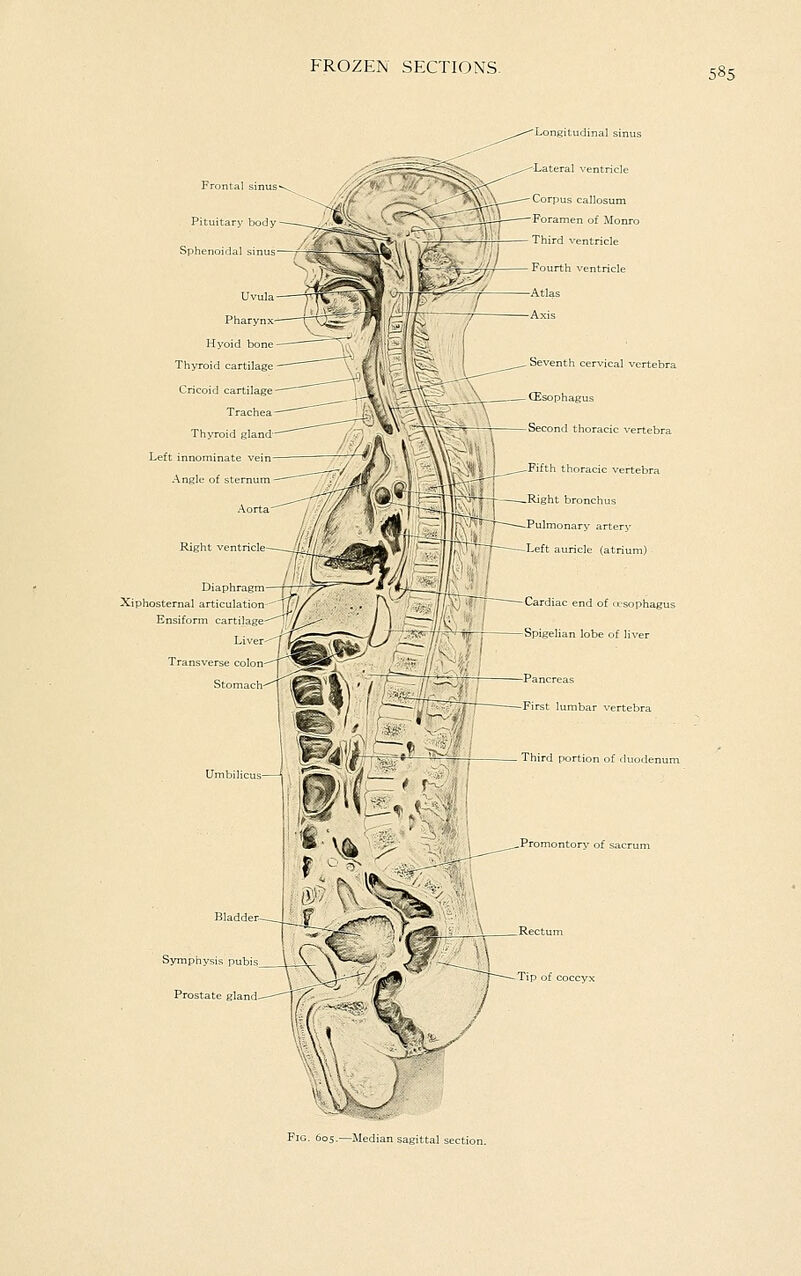 Pituitary body Sphenoidal sinus Uvula Pharynx- Hyoid bone Thyroid cartilage Cricoid cartilage Trachea Thyroid gland- Left innominate vein Angle of sternum Right ventricle Diaphragm Xiphosternal articulation Ensiform cartilage- Seventh cervical vertebra Second thoracic vertebra Fifth thoracic vertebra Transverse colon- Stomach- Bladder- Symphysis pubis. Prostate gland. Cardiac end of usophagu ■Spigelian lobe of liver Third portion of duodenum .Promontory of sacrum Tip of coccyx Fig. 605.—Median sagittal section.