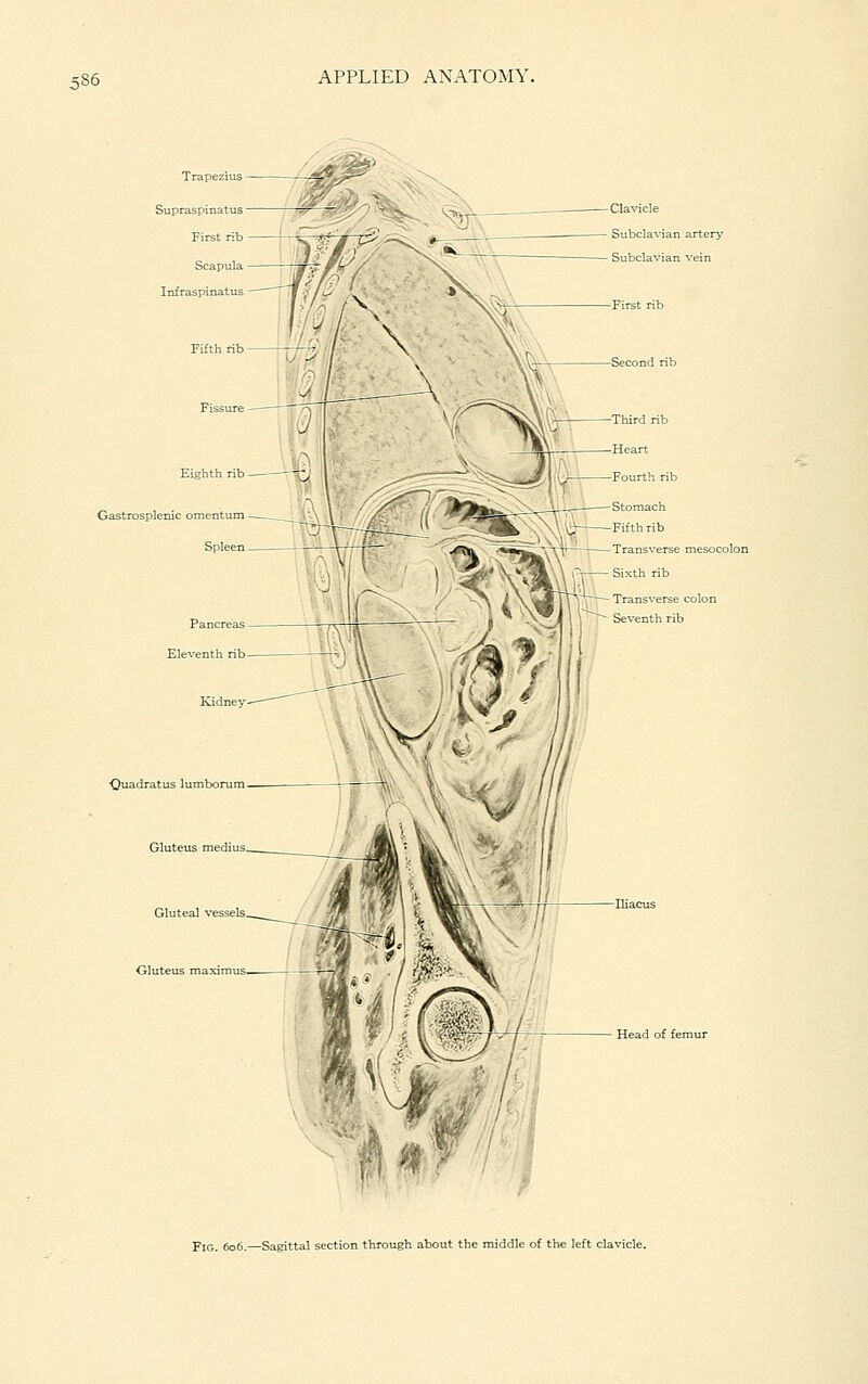 Clavicle Subclavian artery Subclavian vein Gastrosplenic omentum — Spli ■Quadratus lumbonim Head of femur fl ^ ■' Fig. 606.—Sagittal section through about the middle of the left clavicle.