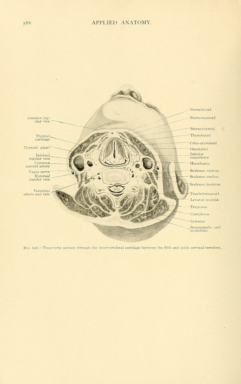 Thwoid gland Internal, jugular vein Common- carotid artery Vagus nerve External jugular vein Sternohyoid Sternomastoid Sternothyroid Thyrohyoid Crico-arytenoid Omohyoid Inferior constrictor (Esophagus Scalenus anticus Scalenus medius Scalenus posticus- Trachelomastoid Levator scapulee Trapezius Complexus Splenius lispinalis and Fig. 608.—Trans : section throueh the intervertebral cartilage en the fifth and sixth (