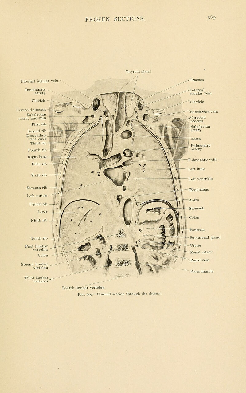 5S9 Internal jugular Coracoid process Subclavian artery and vein Renal Psoas muscle Fourth lumbar vertebra Fig. 60Q.—Coronal section thr ugh the thorax.