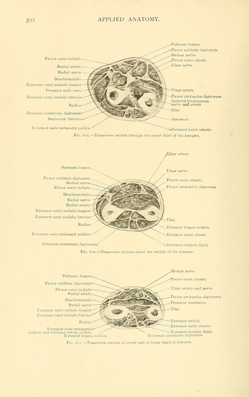 ■Palmaris longus Flexor carpi radialis Radial arterj' Radial nerve Brachiorad iali s Extensor carpi radialis longior Pronator radii teres Extensor carpi radialis brevior Radius Extensor communis digitorum Supinator (brevis) Extensor ossis metacarpi polli Fig. 6i5.^Transv Ulnar artery Flexor profundus digitorum Anterior interosseous nerve and artery Ulna ■^Extensor carpi ulnaris •- section through the upper third of the forearm. Pain > longus Flexor sublimis digitorum Median ne Flexor carpi radialis Brachioradialis Radial ner^-e Radial artery Extensor carpi radialis longior Extensor carpi radialis brevior Radius- Extensor ossis metacarpi polHcis Extensor communis digitorumr carpi uln profundus digitorum ; section about the Extensor minimi digiti ddle of the forearm. Palmaris longus- Flexor sublimis digitorum' Flexor carpi radialis Radial artery. Brachioradialis Radial nerve Extensor carpi radialis longior Extensor carpi radialis brevior Radius Extensor ossis metacarpi pollicis and extensor brevis pollicis Extensor longu; Median ner\'e Flexor carpi ulnaris Ulnar artery and nerve Flexor profundus digitorum Pronator quadratus Ulna Extensor indicis Extensor carpi ulnaris poll Transve ; section of upper part of lower third of forearm,