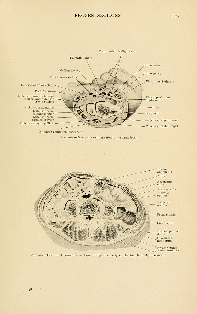 Plexor sublimis digitorum Palmaxis longus Median Flexor carpi radial: Superficial volar artery Extensor ossis metacarpi pollicis and extensor- brevis pollicis Styloid process, radius Extensor carpi radialis longior Extensor carpi radialis brevior Extensor longus pollicis Flexor carpi ulnaris Extensor communis digitorum Fig. 6i8.—Transverse section through the wrist-joint. Semilu Scaphoid Extensor carpi ulnaris Extensor minimi digiti External —  oblique Fig. tiig.—Horizontal transverse section through the body of the fourth lumbar vertebra.