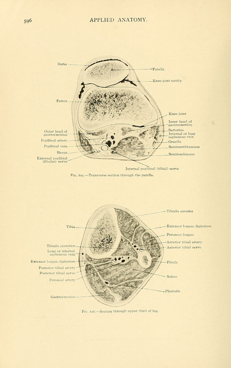 Knee-joint < Outer head of gastrocnemius > v' Popliteal artery Popliteal ■f> '/ Knee-joint Inner head of gastrocnemius i Sartorius Internal or long saphenous vein -Gracilis -Semimembranosus „Semitend; Internal popliteal (tibial) 3 Fig. 625.—Transverse section through the patella. Tibialis posterior. Long or internal saphenous vein Extensor longus digitorum Posterior tibial artery Posterior tibial nerve Peroneal artery Gastrocnemius Tibialis anterior Extensor longus digito Peroneus longus y—Anterior tibial artery Anterior tibial nerve Fig. 626.—Section through upper third of leg.