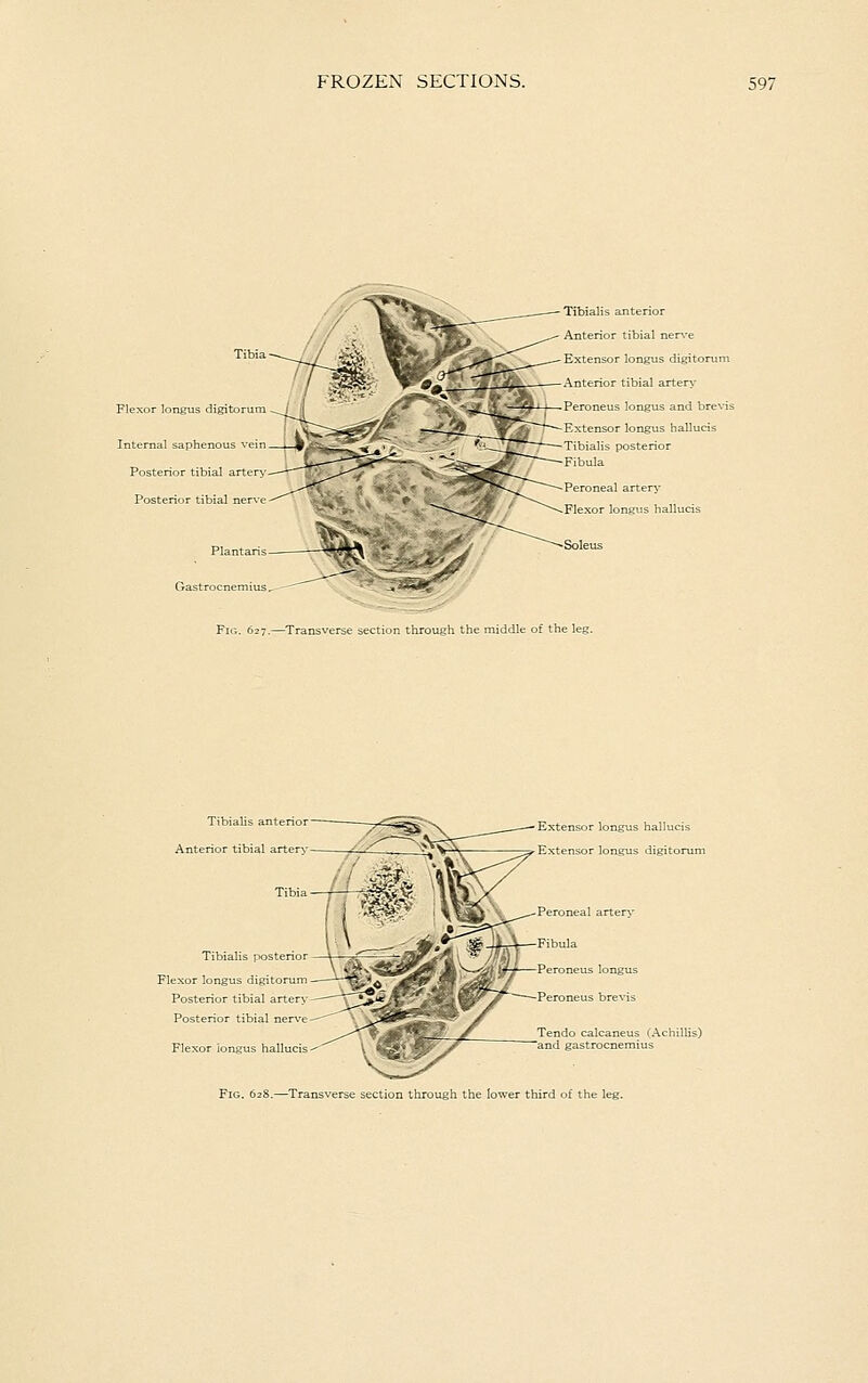 Fie ' longus digitor Internal saphenous vein Posterior tibial artery. Posterior tibial nerve Plantaris Gastrocnemius Tibialis anterior Anterior tibial ner\-e Extensor longus digitorum Anterior tibial arten' Peroneus longus and brevis Extensor longus hallucis Tibialis posterior Fibula Peroneal artery Flexor longus hallucis Soleus Fig. 627.—Transverse section through the middle of the leg Tibialis anterior Anterior tibial arteo' Tibialis posterio: Flexor longus digitt Posterior tibial artery Posterior tibial nerve Extensor longus halluc Extensor longus digito Peroneal artery Fibula Peroneus longus Peroneus brevis Tendo calcaneus (Achillis) and, gastrocnemius