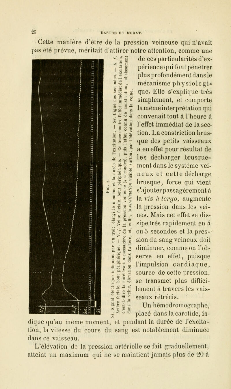 Cette manière d'être de la pression veineuse qui n'avait pas été prévue, méritait d'attirer notre attention, comme une de ces particularités d'ex- périence qui font pénétrer plus profondément dans le mécanisme physiologi- que. Elle s'explique très simplement, et comporte lamêmeinterprétation qui convenait tout à l'heure à l'effet immédiat de la sec- tion. La constriction brus- que des petits vaisseaux a en effet pour résultat de les décharger brusque- ment dans le système vei- neux et cette décharge brusque^ force qui vient s'ajouterpassagèrement à la vis à tergo, augmente la pression dans les vei- nes. Mais cet effet se dis- sipe très rapidement en 4 ou 5 secondes et la pres- sion du sang veineux doit diminuer, comme on l'ob- serve en effet, puisque l'impulsion cardiaque, source de cette pression, se transmet plus diffici- lement à travers les vais- seaux rétrécis. Un hémodromographe, placé dans la carotide, in- dique qu'au môme moment, et pendant la durée de l'excita- tion, la vitesse du cours du sang est notablement diminuée dans ce vaisseau. L'élévation de la pression artérielle se fait graduellement, atteint un maximum qui ne se maintient jamais plus de 20 à — I a. s 0) o a» -i Ë — 5 -2 <^ „' 5 :^ p O) > ? ^ ô g == -1 ^^ « „ .E