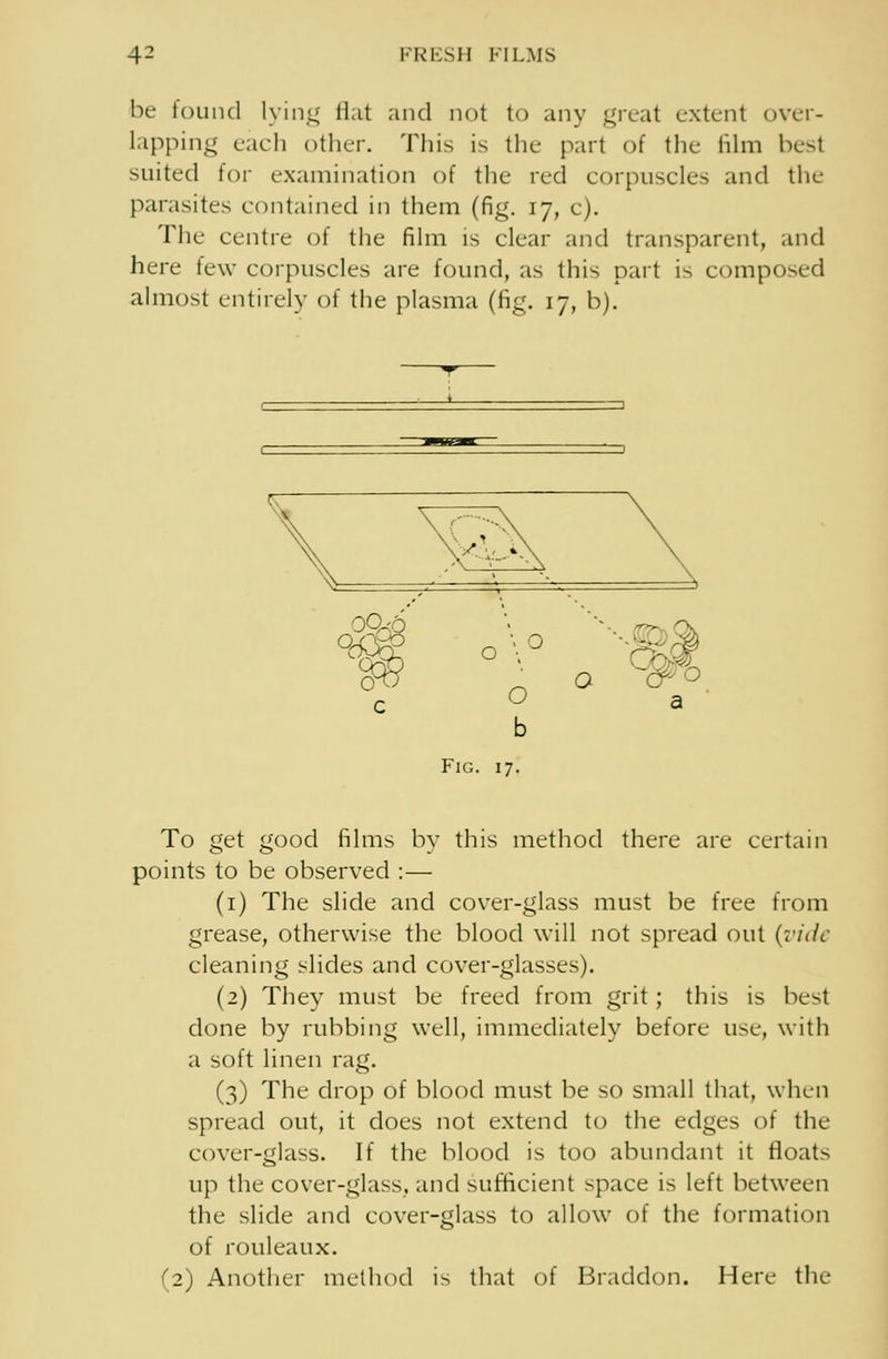 be found lying flat and not to any great extent over- lapping each other. This is the part of the film best suited for examination of the red corpuscles and the parasites contained in them (fig. 17, e). The centre of the film is clear and transparent, and here lew corpuscles are found, as this part is composed almost entirely of the plasma (fig. 17, b). 0 V c 0 b Fig. 17. o a To get good films by this method there are certain points to be observed : — (1) The slide and cover-glass must be free from grease, otherwise the blood will not spread out (vide cleaning slides and cover-glasses). (2) They must be freed from grit; this is best done by rubbing well, immediately before use, with a soft linen rag. (3) The drop of blood must be so small that, when spread out, it does not extend to the edges of the cover-glass. If the blood is too abundant it floats up the cover-glass, and sufficient space is left between the slide and cover-glass to allow of the formation of rouleaux. (2) Another method is that of Braddon. Here the