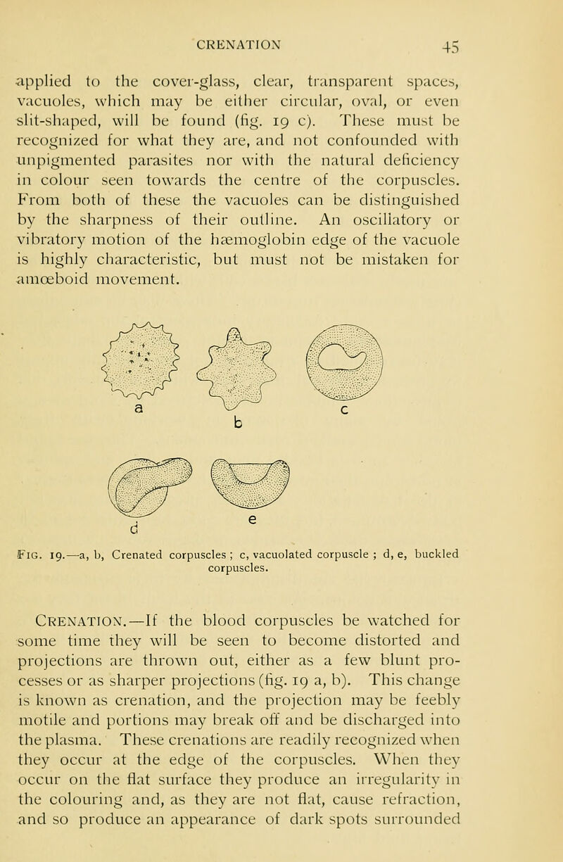 applied to the cover-glass, clear, transparent spaces, vacuoles, which may be either circular, oval, or even slit-shaped, will be found (fig. 19 c). These must be recognized for what they are, and not confounded with unpigmented parasites nor with the natural deficiency in colour seen towards the centre of the corpuscles. From both of these the vacuoles can be distinguished by the sharpness of their outline. An oscillatory or vibratory motion of the haemoglobin edge of the vacuole is highly characteristic, but must not be mistaken for amoeboid movement. Fig. 19.—a, b, Crenated corpuscles ; c, vacuolated corpuscle ; d, e, buckled corpuscles. Crenation.—If the blood corpuscles be watched for some time they will be seen to become distorted and projections are thrown out, either as a few blunt pro- cesses or as sharper projections (fig. 19 a, b). This change is known as crenation, and the projection may be feebly motile and portions may break off and be discharged into the plasma. These crenations are readily recognized when they occur at the edge of the corpuscles. When they occur on the flat surface they produce an irregularity in the colouring and, as they are not flat, cause refraction, and so produce an appearance of dark spots surrounded