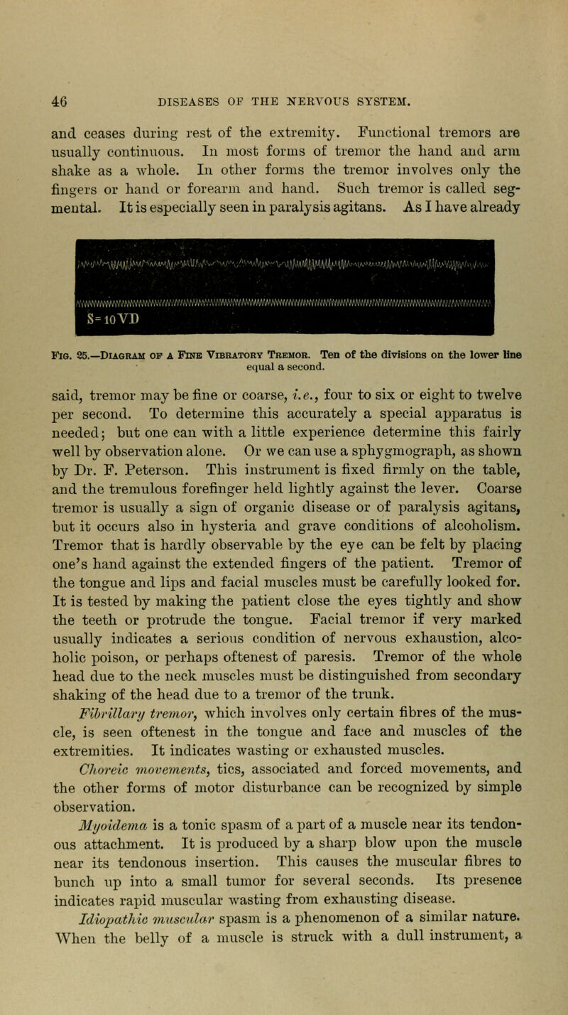 and ceases during rest of the extremity. Functional tremors are usually continuous. In most forms of tremor the hand and arm shake as a whole. In other forms the tremor involves only the fingers or hand or forearm and hand. Such tremor is called seg- mental. It is especially seen in paralysis agitans. As I have already S=10VD Fig. 25.—Diagram of a Fine Vibratory Tremor. Ten of the divisions on the lower line equal a second. said, tremor may be fine or coarse, i.e., four to six or eight to twelve per second. To determine this accurately a special apparatus is needed; but one can with a little experience determine this fairly well by observation alone. Or we can use a sphygmograph, as shown by Dr. F. Peterson. This instrument is fixed firmly on the table, and the tremulous forefinger held lightly against the lever. Coarse tremor is usually a sign of organic disease or of paralysis agitans, but it occurs also in hysteria and grave conditions of alcoholism. Tremor that is hardly observable by the eye can be felt by placing one's hand against the extended fingers of the patient. Tremor of the tongue and lips and facial muscles must be carefully looked for. It is tested by making the patient close the eyes tightly and show the teeth or protrude the tongue. Facial tremor if very marked usually indicates a serious condition of nervous exhaustion, alco- holic poison, or perhaps oftenest of paresis. Tremor of the whole head due to the neck muscles must be distinguished from secondary shaking of the head due to a tremor of the trunk. Fibrillary tremor, which involves only certain fibres of the mus- cle, is seen oftenest in the tongue and face and muscles of the extremities. It indicates wasting or exhausted muscles. Choreic movements, tics, associated and forced movements, and the other forms of motor disturbance can be recognized by simple observation. Myoidema is a tonic spasm of a part of a muscle near its tendon- ous attachment. It is produced by a sharp blow upon the muscle near its tendonous insertion. This causes the muscular fibres to bunch up into a small tumor for several seconds. Its presence indicates rapid muscular wasting from exhausting disease. Idiopathic muscular spasm is a phenomenon of a similar nature. When the belly of a muscle is struck with a dull instrument, a