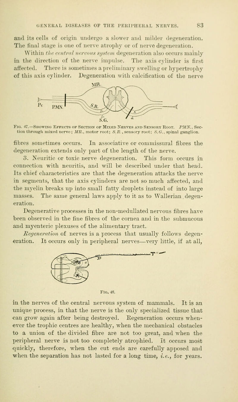 and its cells of origin undergo a slower and milder degeneration. The final stage is one of nerve atrophy or of nerve degeneration. Within the central nrrrmis s;/st, hi degeneration also occurs mainly in the direction of the nerve impulse. The axis cylinder is first affected. There is sometimes a preliminary swelling or hypertrophy of this axis cylinder. Degeneration with calcification of the nerve S.G. Fk;. 17.—Showing Effects of Section of Mixed Nerves and Sensory Root. PMN., Sec- tion through mixed nerve; MR., motor root; S.R., sensory root; S.G., spinal ganglion. fibres sometimes occurs. In associative or commissural fibres the degeneration extends only part of the length of the nerve. 3. Neuritic or toxic nerve degeneration. This form occurs in connection with neuritis, and will be described under that head. Its chief characteristics are that the degeneration attacks the nerve in segments, that the axis cylinders are not so much affected, and the myelin breaks up into small fatty droplets instead of into large masses. The same general laws apply to it as to Wallerian degen- eration. Degenerative processes in the non-medullated nervous fibres have been observed in the fine fibres of the cornea and in the submucous and myenteric plexuses of the alimentary tract. Regeneration of nerves is a process that usually follows degen- eration. It occurs only in peripheral nerves—very little, if at all, FIG. 48. in the nerves of the central nervous system of mammals. It is an unicpie process, in that the nerve is the only specialized tissue that can grow again after being destroyed. Regeneration occurs when- ever the trophic centres are healthy, when the mechanical obstacles to a union of the divided fibre are not too great, and when the peripheral nerve is not too completely atrophied. It occurs most quickly, therefore, when the cut ends are carefully apposed and when the separation has not lasted for a long time, i.e., for years.