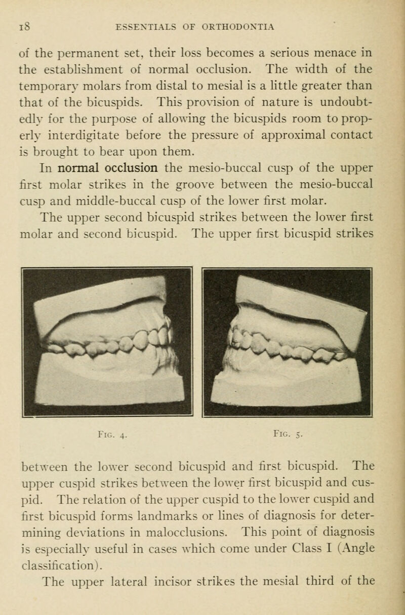 of the permanent set, their loss becomes a serious menace in the estabHshment of normal occlusion. The width of the temporary molars from distal to mesial is a httle greater than that of the bicuspids. This provision of nature is undoubt- edly for the purpose of allowing the bicuspids room to prop- erly interdigitate before the pressure of approximal contact is brought to bear upon them. In normal occlusion the mesio-buccal cusp of the upper lirst molar strikes in the groove between the mesio-buccal cusp and middle-buccal cusp of the lower first molar. The upper second bicuspid strikes between the lower first molar and second bicuspid. The upper first bicuspid strikes Fig. 4. Fig. between the lower second bicuspid and first bicuspid. The upper cuspid strikes between the lower first bicuspid and cus- pid. The relation of the upper cuspid to the lower cuspid and first bicuspid forms landmarks or lines of diagnosis for deter- mining deviations in malocclusions. This point of diagnosis is especially useful in cases which come under Class I (Angle classification). The upper lateral incisor strikes the mesial third of the