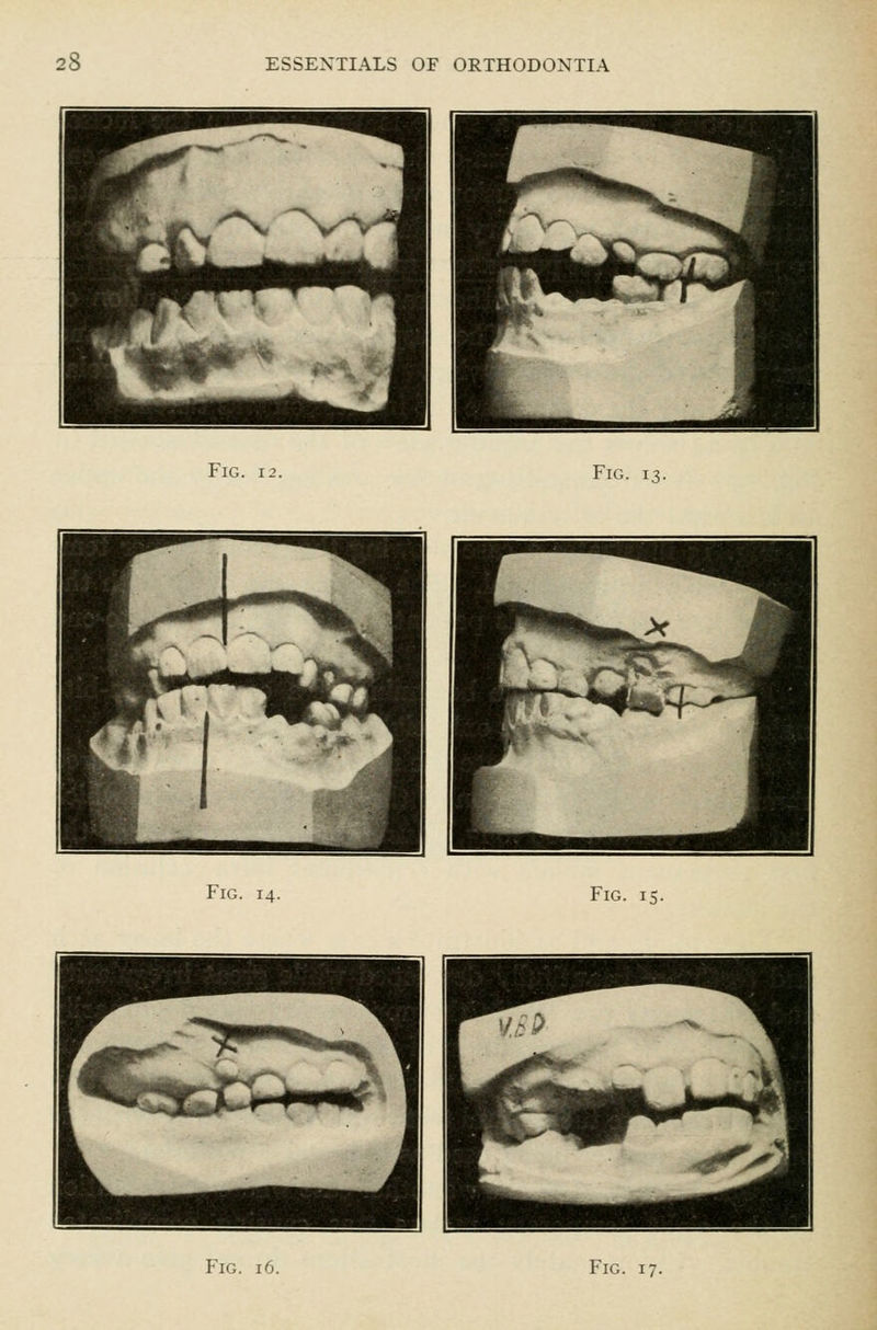 Fig. 12. Fig. 13. Fig. 14. Fig. 15.