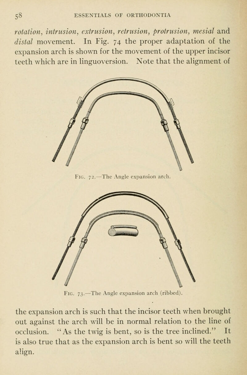 rotation, intrusion, extrusion, retrusion, protrusion, mesial and distal movement. In Fig. 74 the proper adaptation of the expansion arch is shown for the movement of the upper incisor teeth which are in linguoversion. Note that the alignment of Fig. 72.—The Angle expansion arch. Fig. 73.—The Angle expansion arch (ribbed). the expansion arch is such that the incisor teeth when brought out against the arch will be in normal relation to the line of occlusion. As the twig is bent, so is the tree inclined. It is also true that as the expansion arch is bent so will the teeth align.